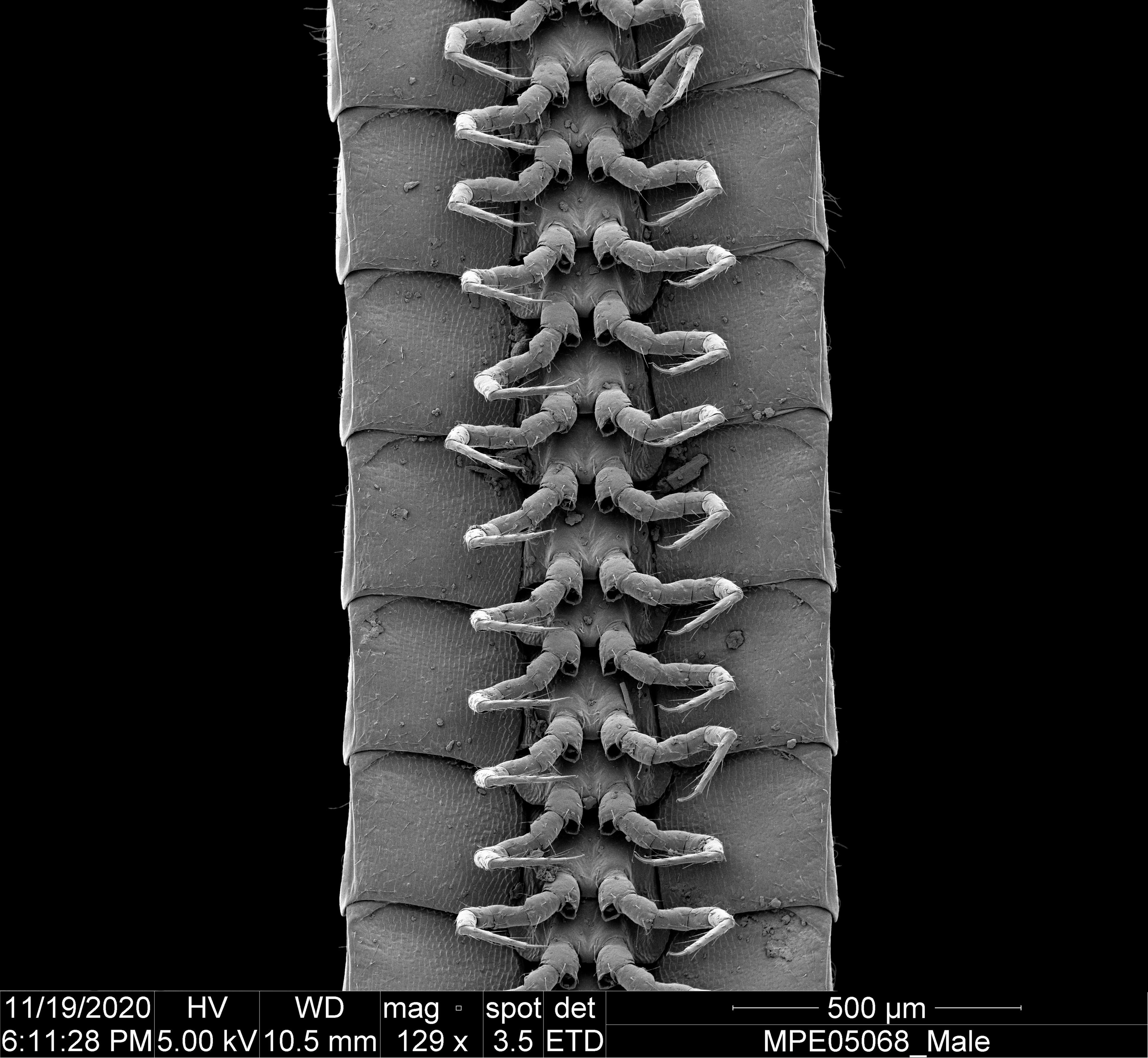 A ventral view of the legs of a male Eumillipes persephone