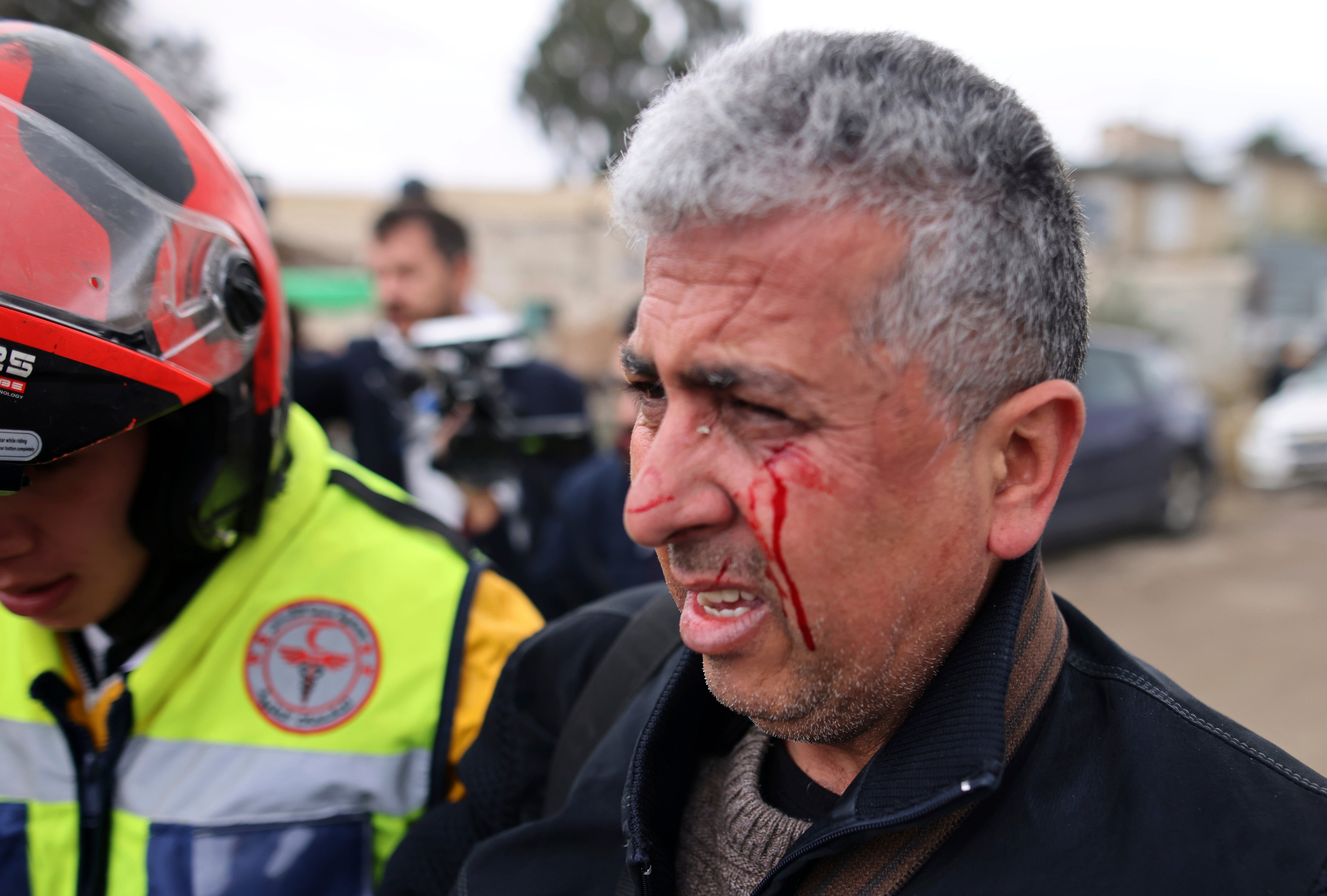 Israel AP Photographer Beaten