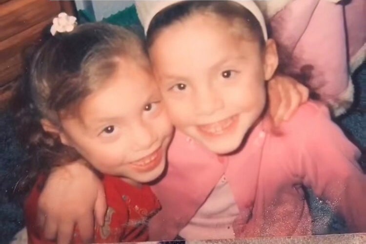 The former conjoined twins were the best of friends until both girls fell ill at 13 when mesh from the surgery that separated them became infected; Michaela became septic and died while Gabby survived