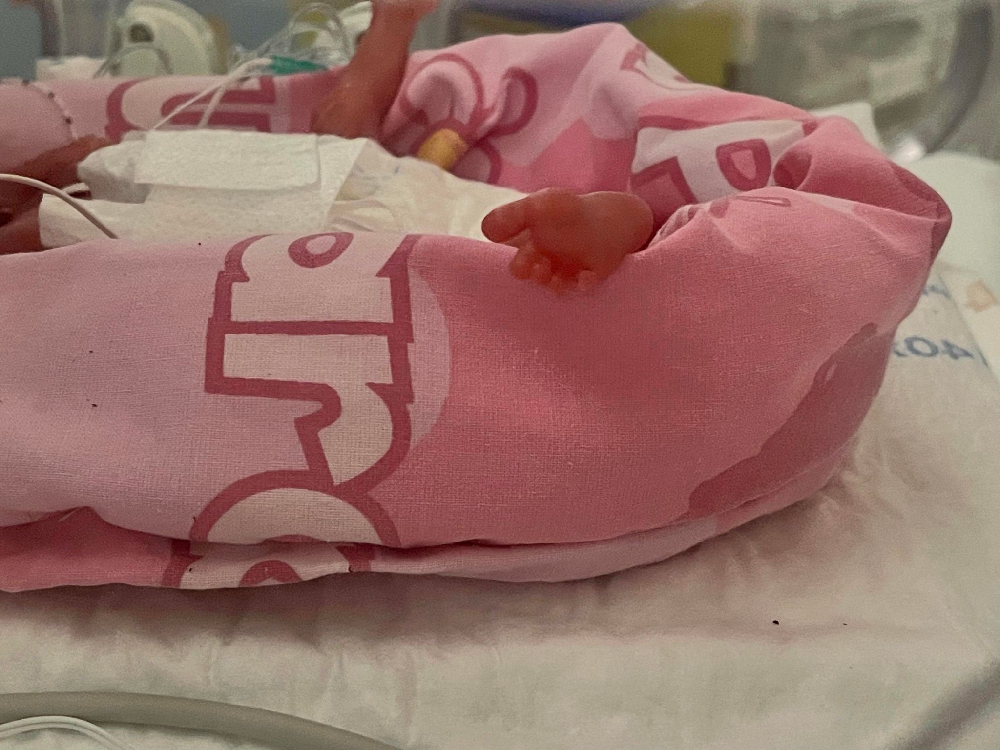 Hannah now weighs 547g and will go home when strong enough