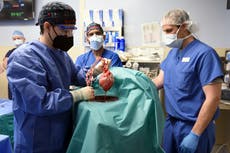 The 60-year journey to a pig-heart transplant