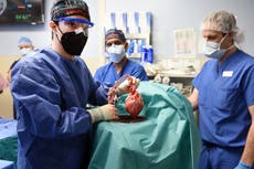 Man receives first successful transplant of pig heart into human body