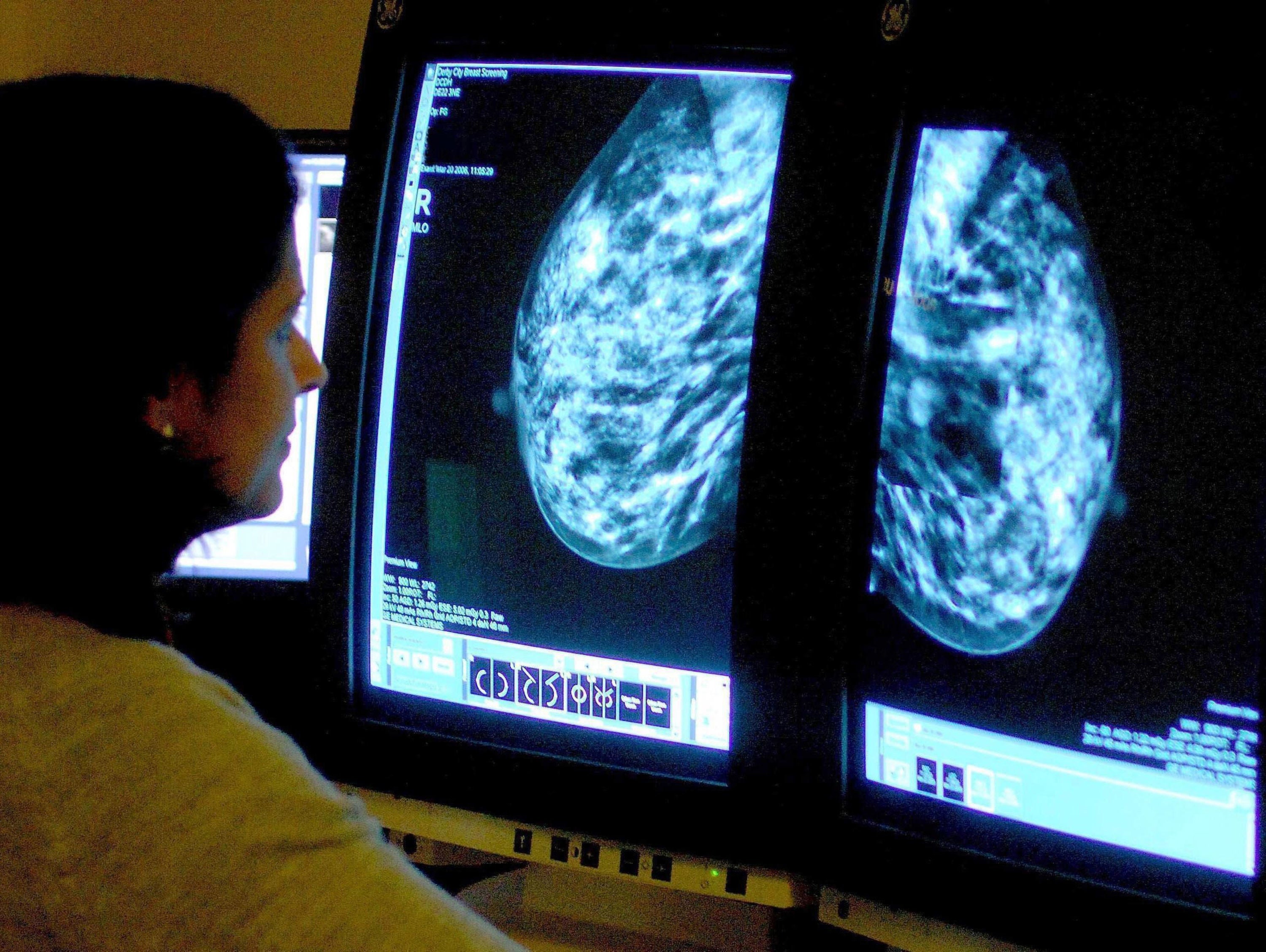 There has been a steep rise in the number of women facing longer waits to see a breast cancer specialist (Rui Vieira/PA)