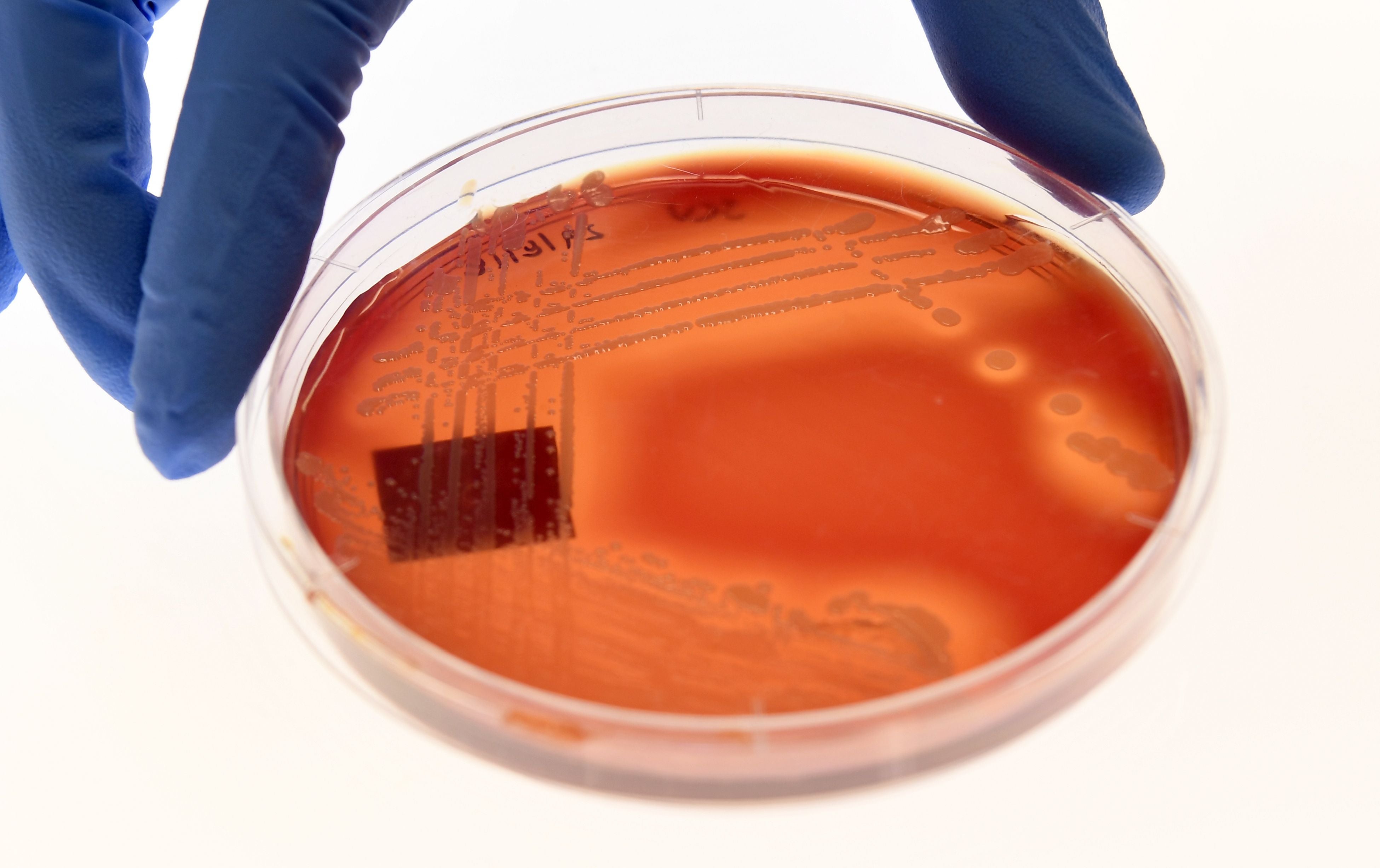 Jean Lee, a PhD student at Melbourne’s Doherty Institute, displays the superbug ‘Staphylcocus epidermidis’ on an agar plate in Melbourne on 4 September 2018