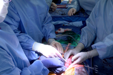 Kidneys from genetically modified pig transplanted into brain dead human