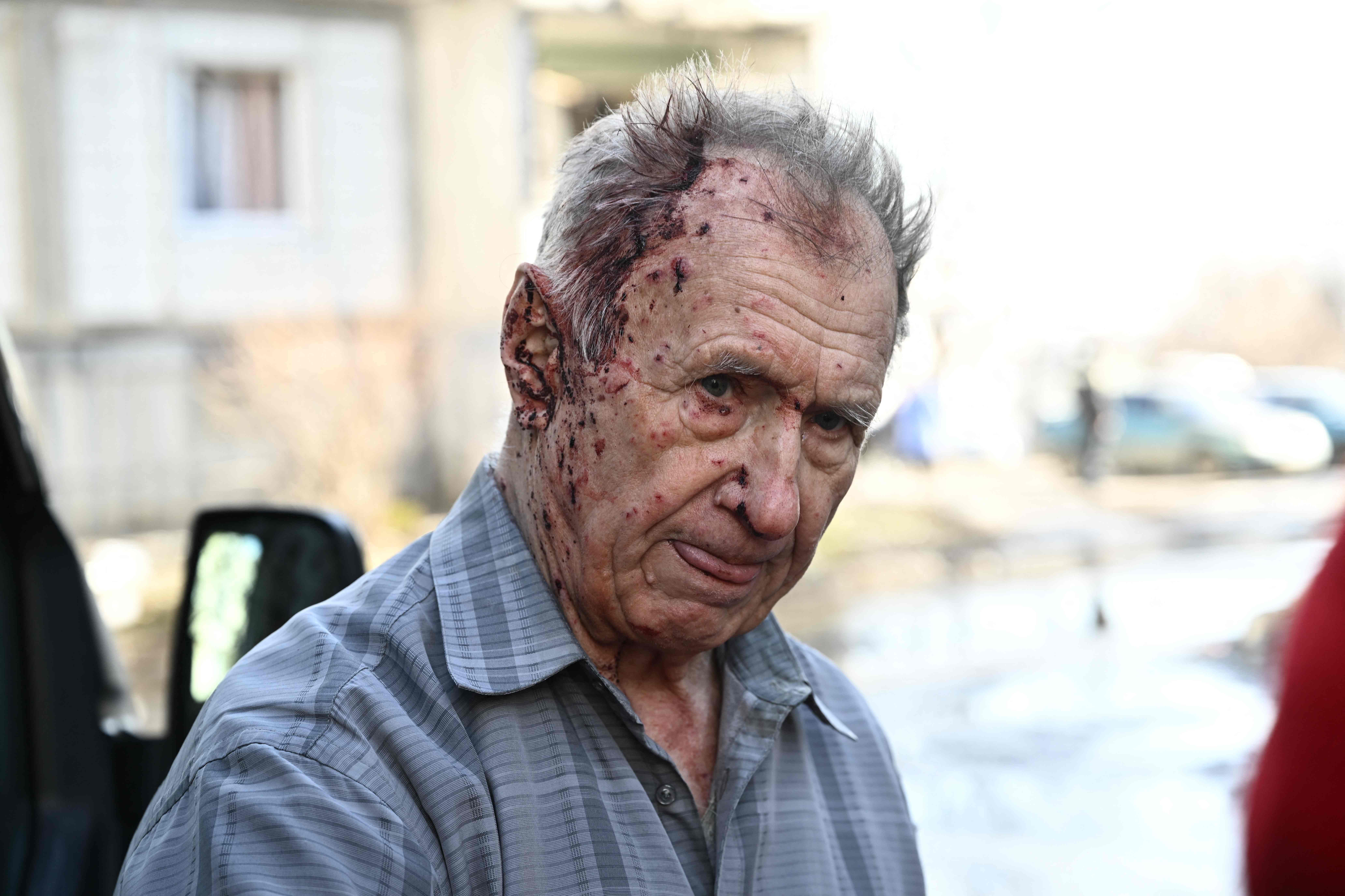 An injured man stands by a vehicle of an Emergency unit to receive medical assistance after bombings on the eastern Ukraine town of Chuguiv on 24 February 2022, as Russian armed forces are trying to invade Ukraine from several directions