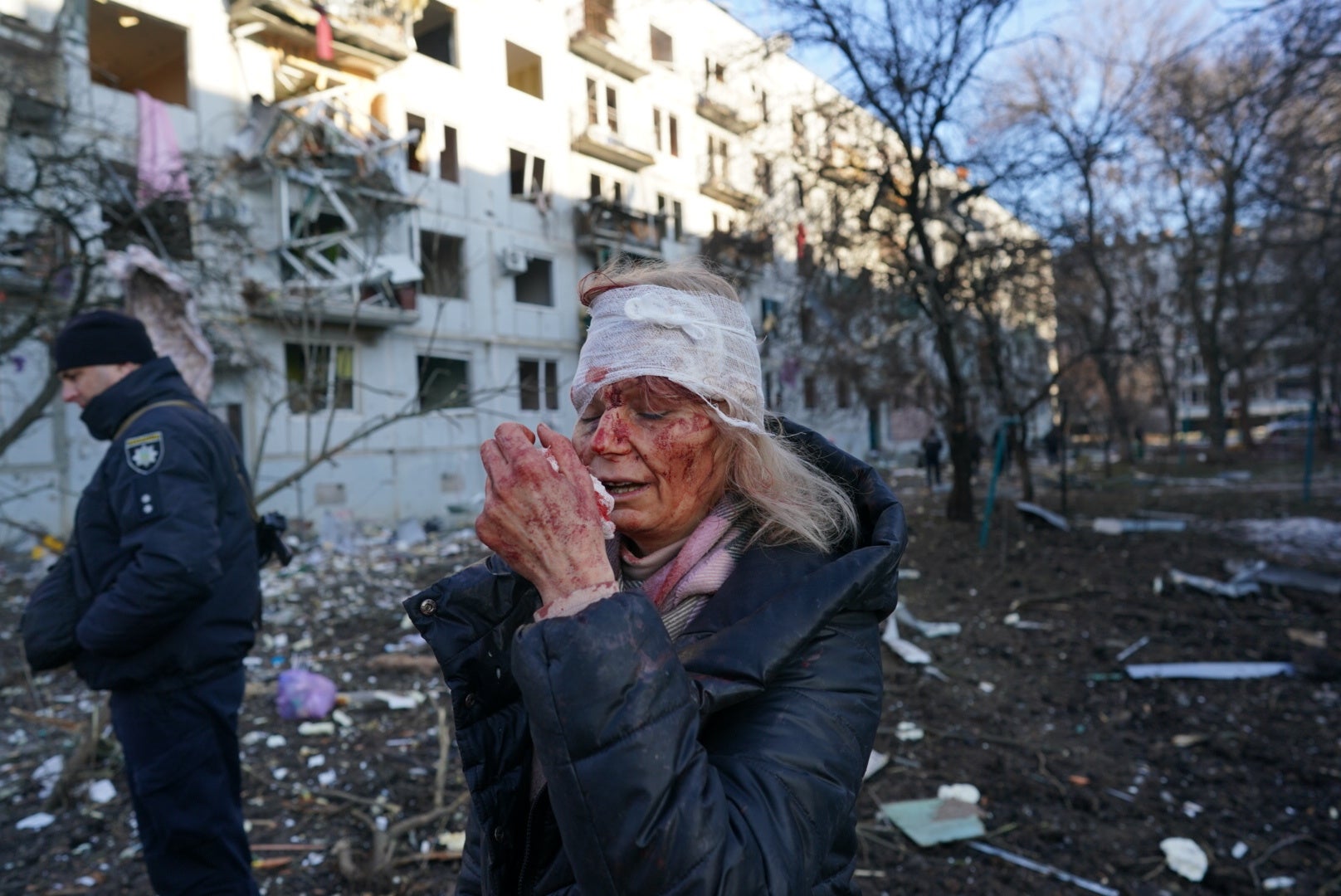 Olena Kurilo, with a heavily bandaged face, outside her home in Chuguev