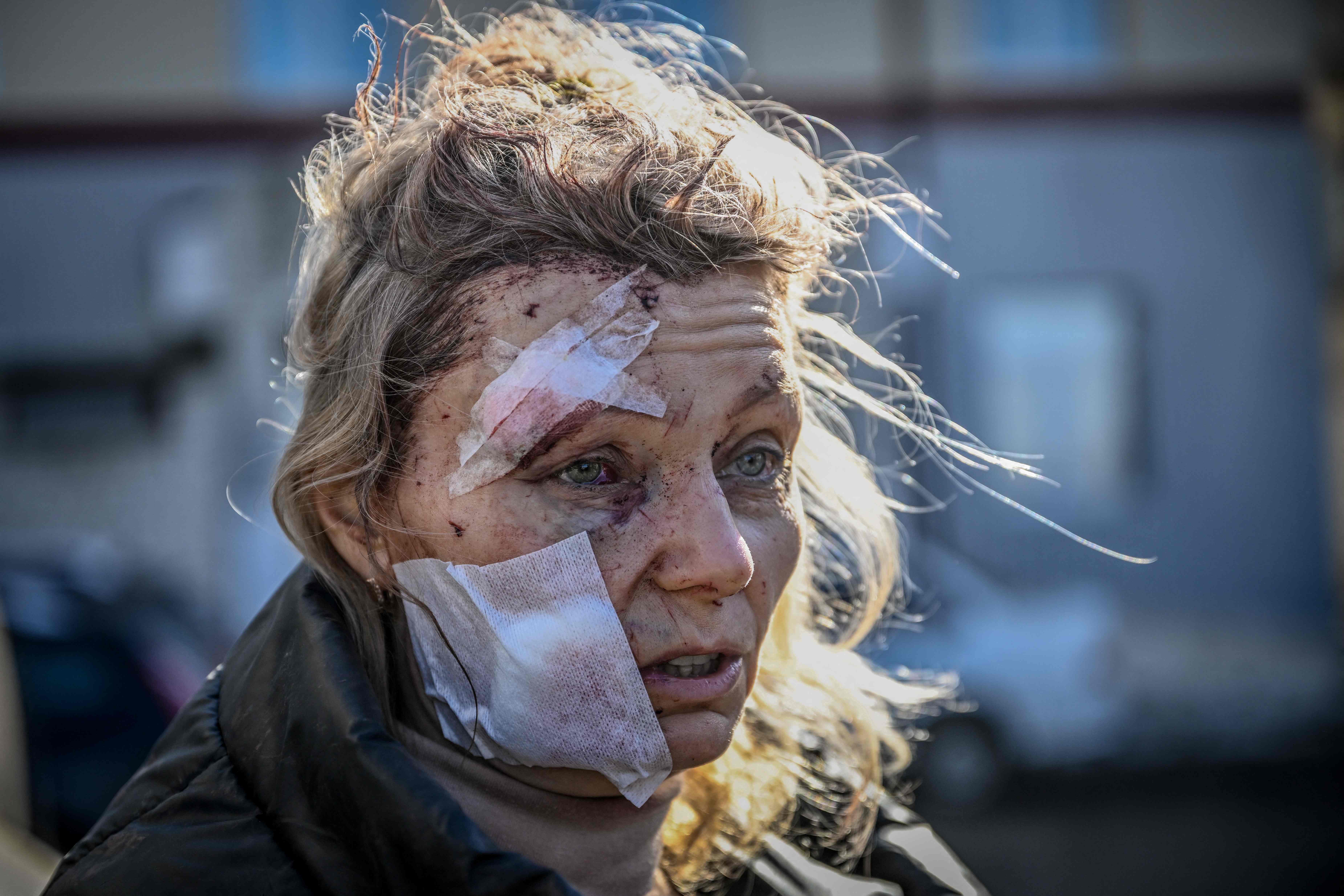 A wounded woman stands outside a hospital after the bombing of the eastern Ukraine town of Chuguiv on 24 February 2022