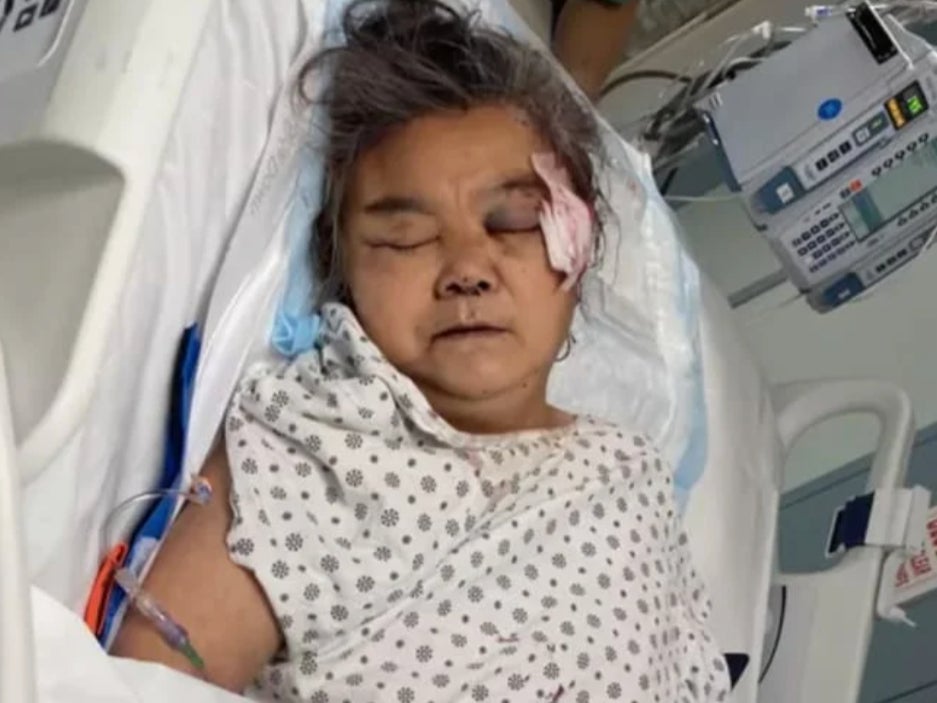 Grandmother dies two months after being struck in the head with a rock in random NYC attack