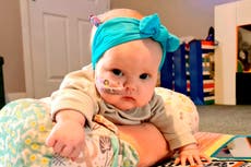 Toddler with brain tumour ‘hours from death’ after doctors dismissed swollen head as ‘normal baby stuff’