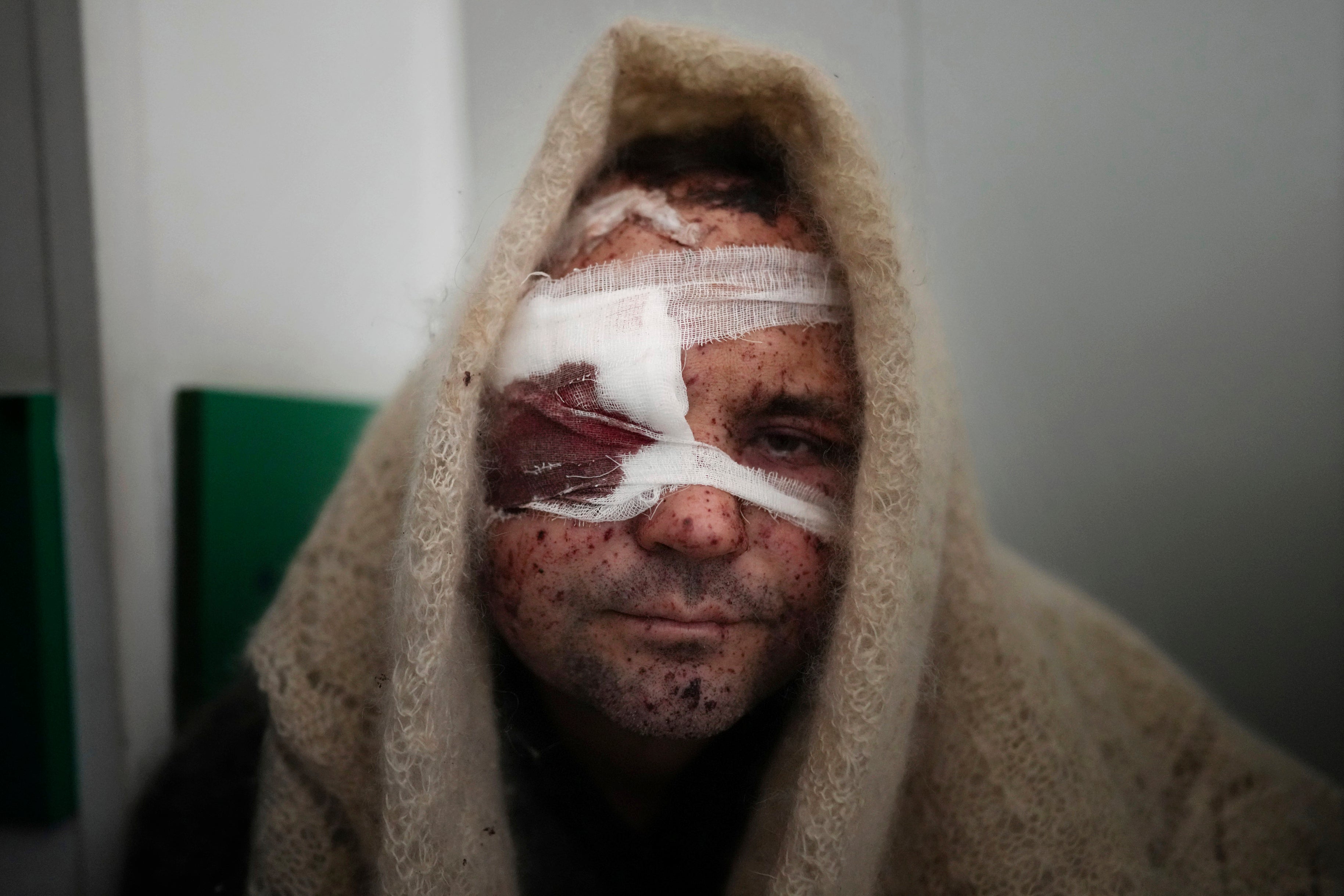 Serhiy Kralya after surgery at a hospital in Mariupol