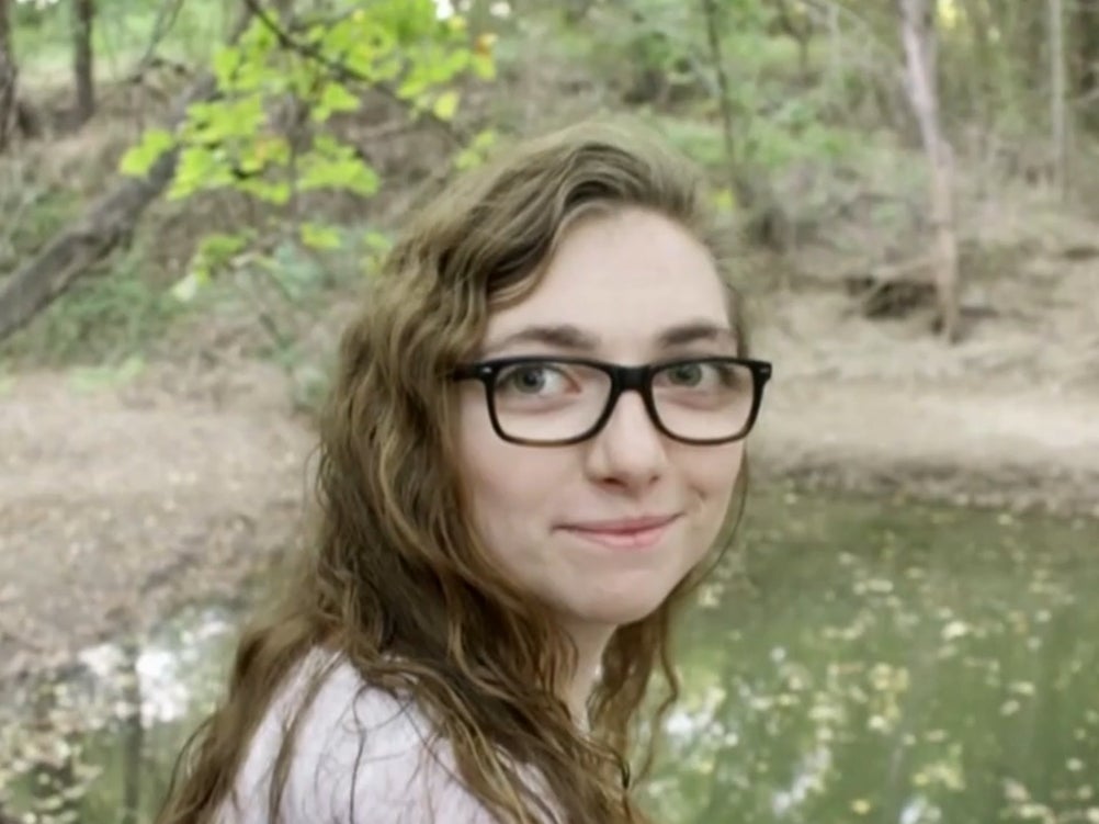 Jacqueline Durand, 22, is pictured before she had most of her face torn off by two rescue dogs last year