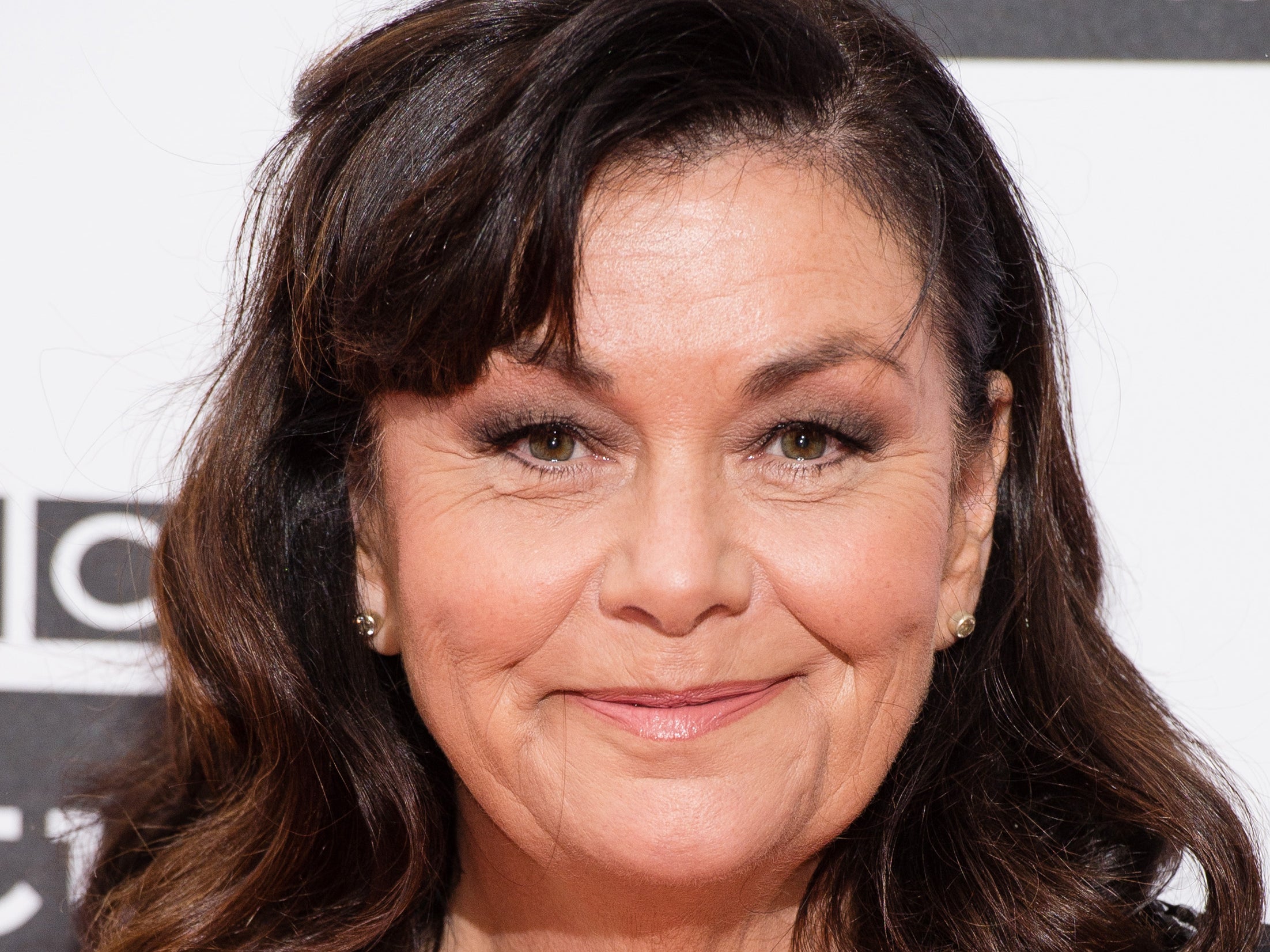 Dawn French says doctors thought she had a brain tumour after skull felt like it was ‘collapsing inwards’