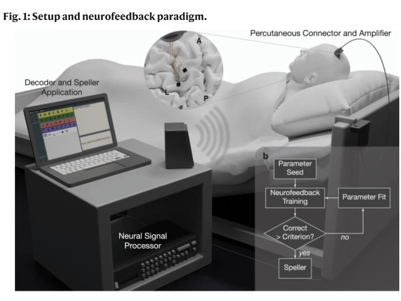 The patient was provided auditory feedback of neural activity levels through a nearby speaker, which allowed them to adjust frequencies to generate ‘yes’ and ‘no’ responses