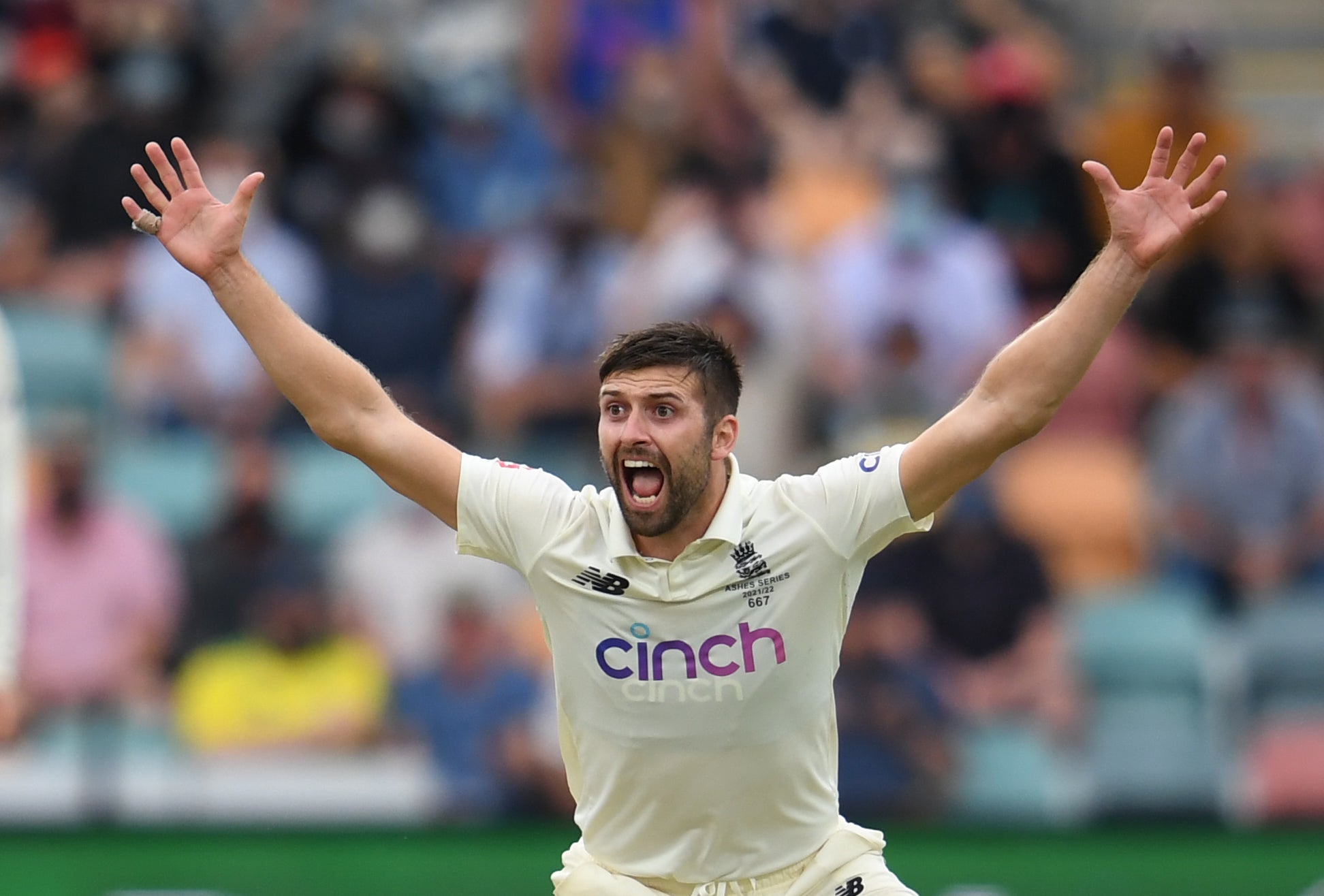 England’s Mark Wood has gone under the knife (Darren England via AAP)