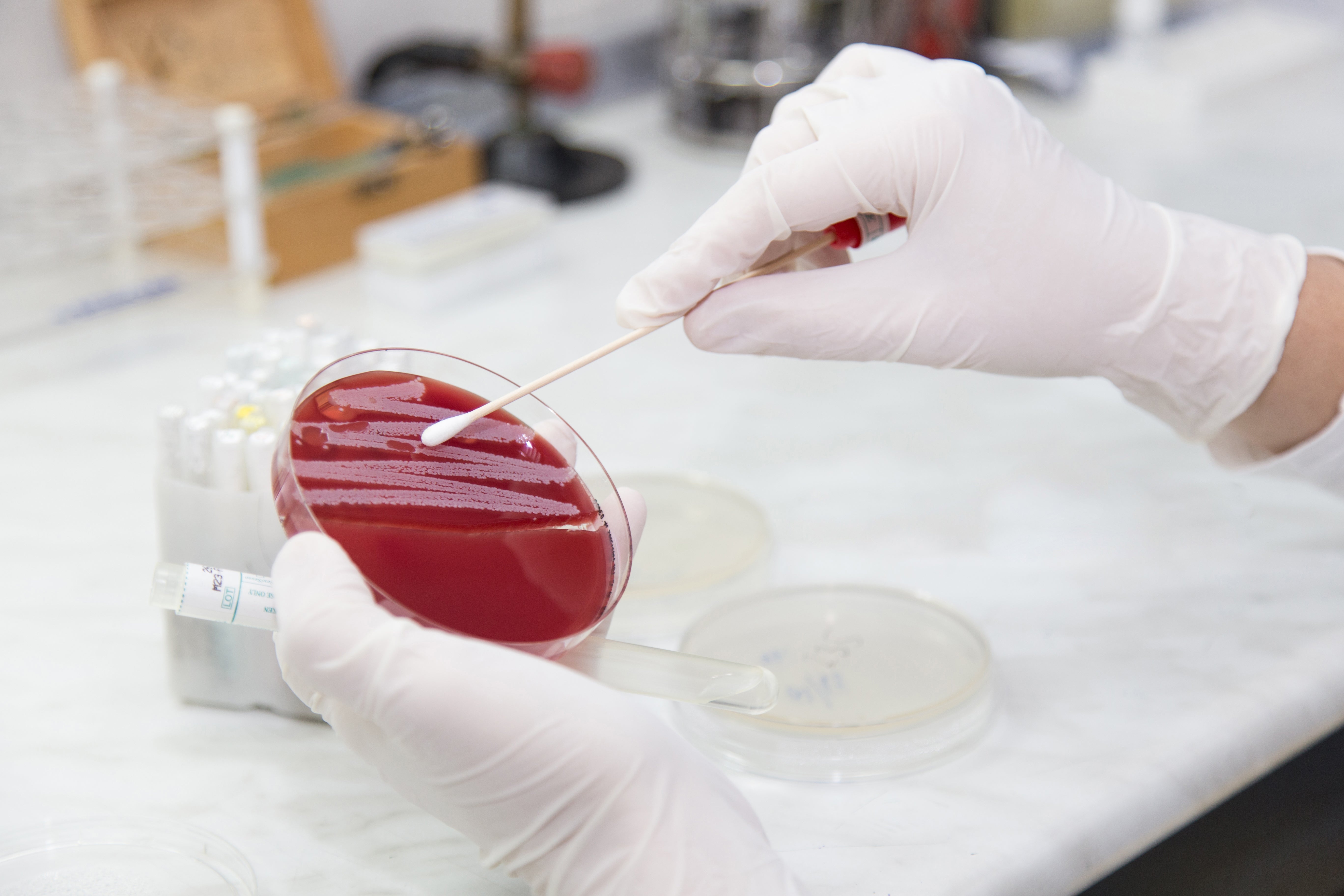 Superbugs pose a significant threat to humans