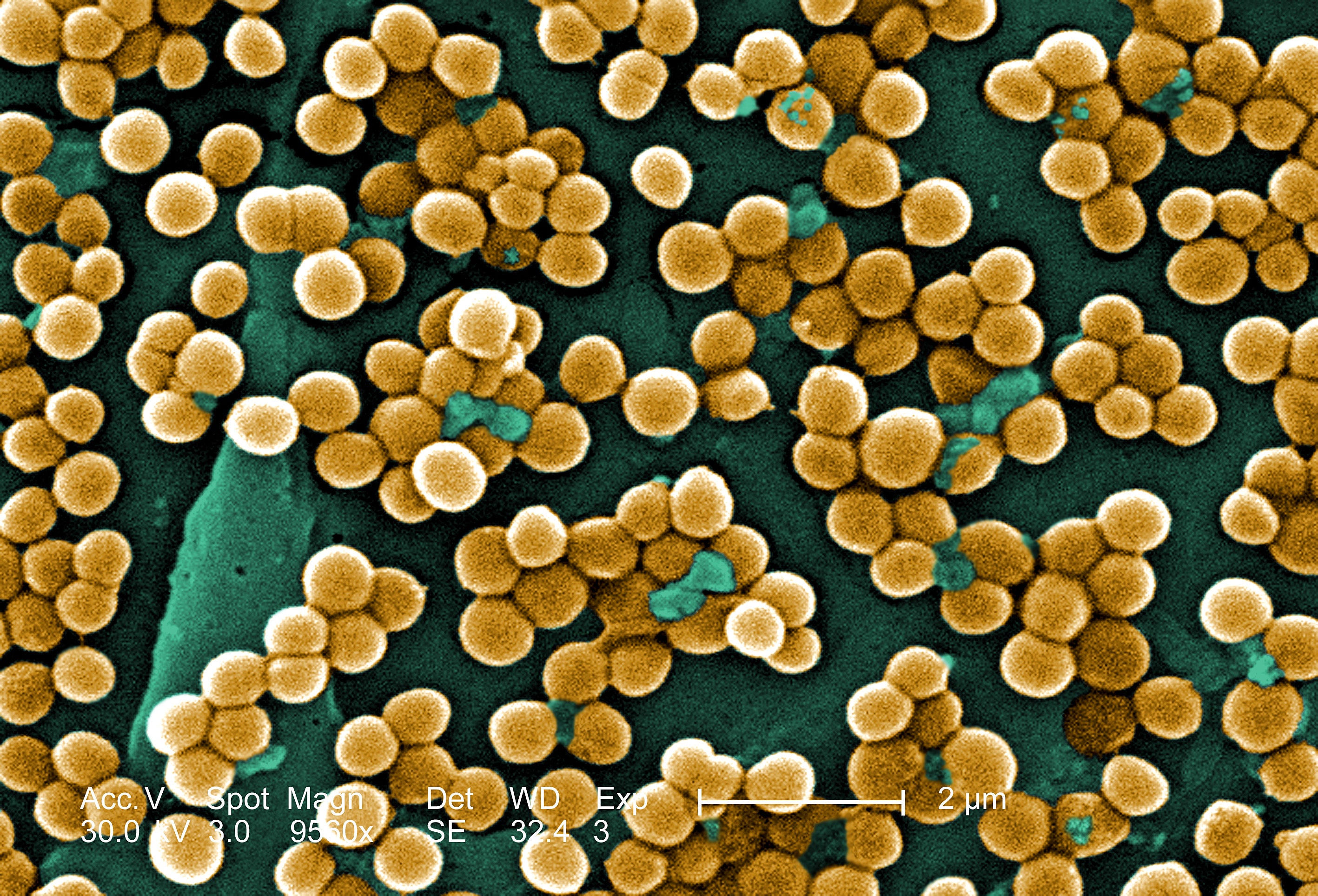 A photograph of the MRSA bacteria