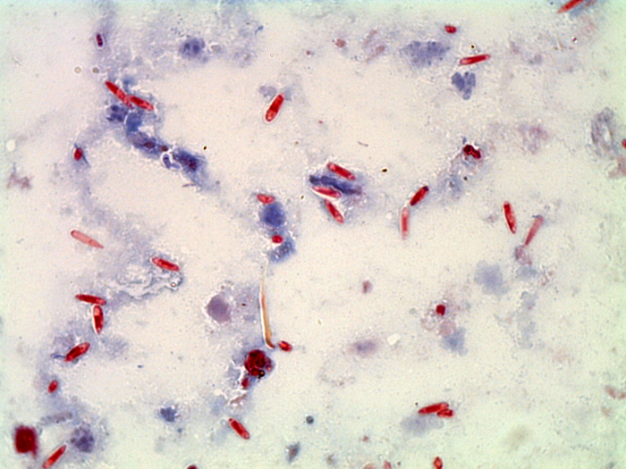 Microsporidia spores collected from a tawny crazy ant at Pace Bend Park in central Texas