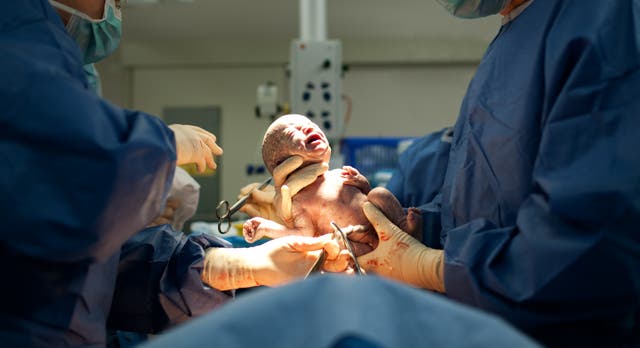 <p>New NHS data shows that births through caesarean section have overtaken ‘natural’ vaginal births for the first time</p>