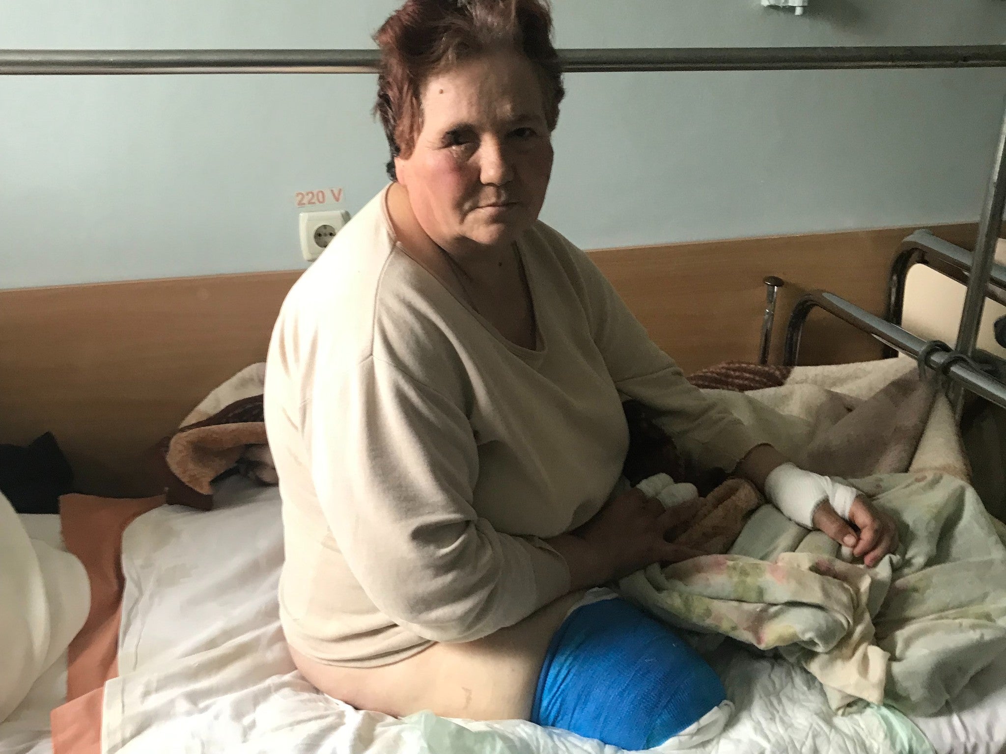 Antonina Budnik, a patient in a hospital in Chernihiv, who lost a leg and may lose her sight in one eye