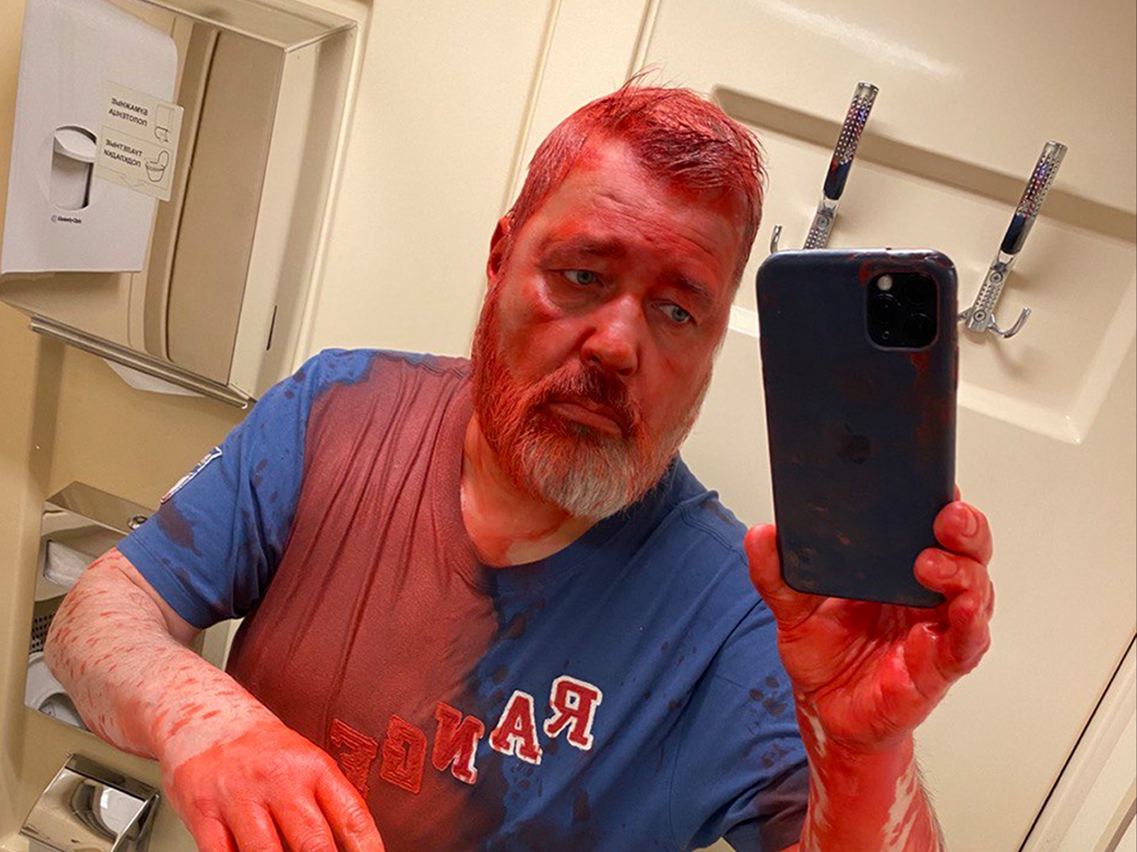 Nobel Peace Prize-winning newspaper editor Dmitry Muratov was attacked on a Russian train