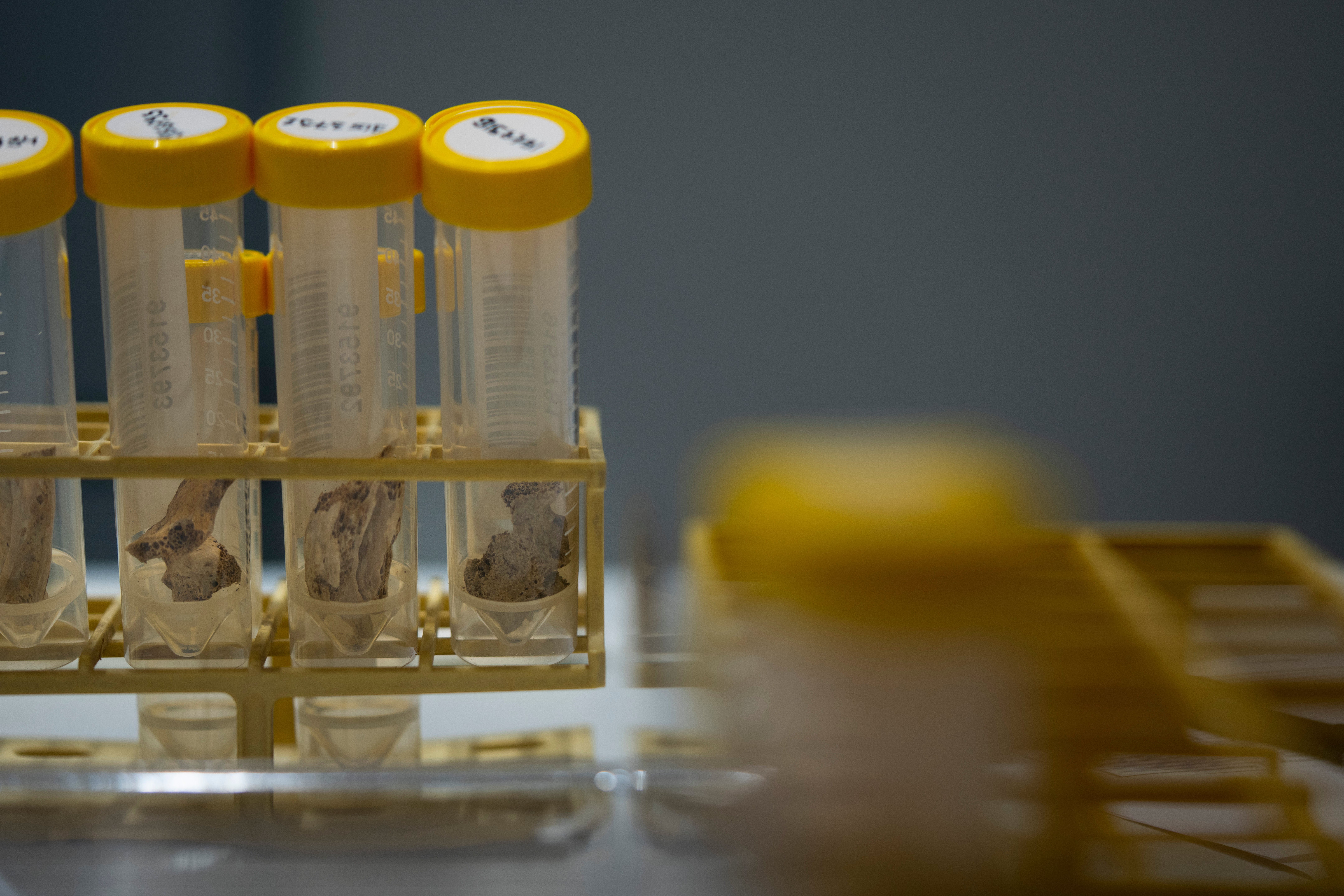 Netherlands Russia Ukraine War Identifying The Dead