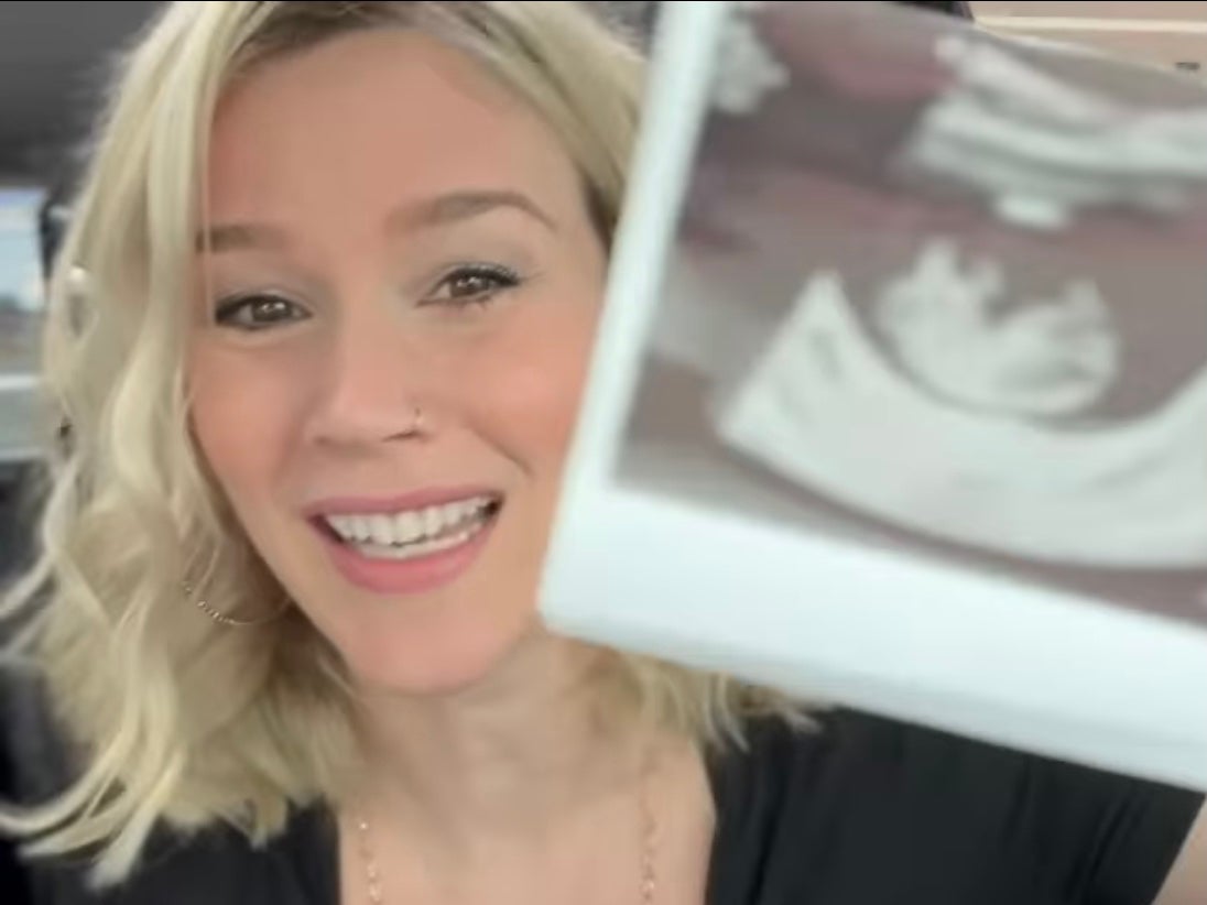 Stone shared her baby scan with her 456,000 followers on Instagram.