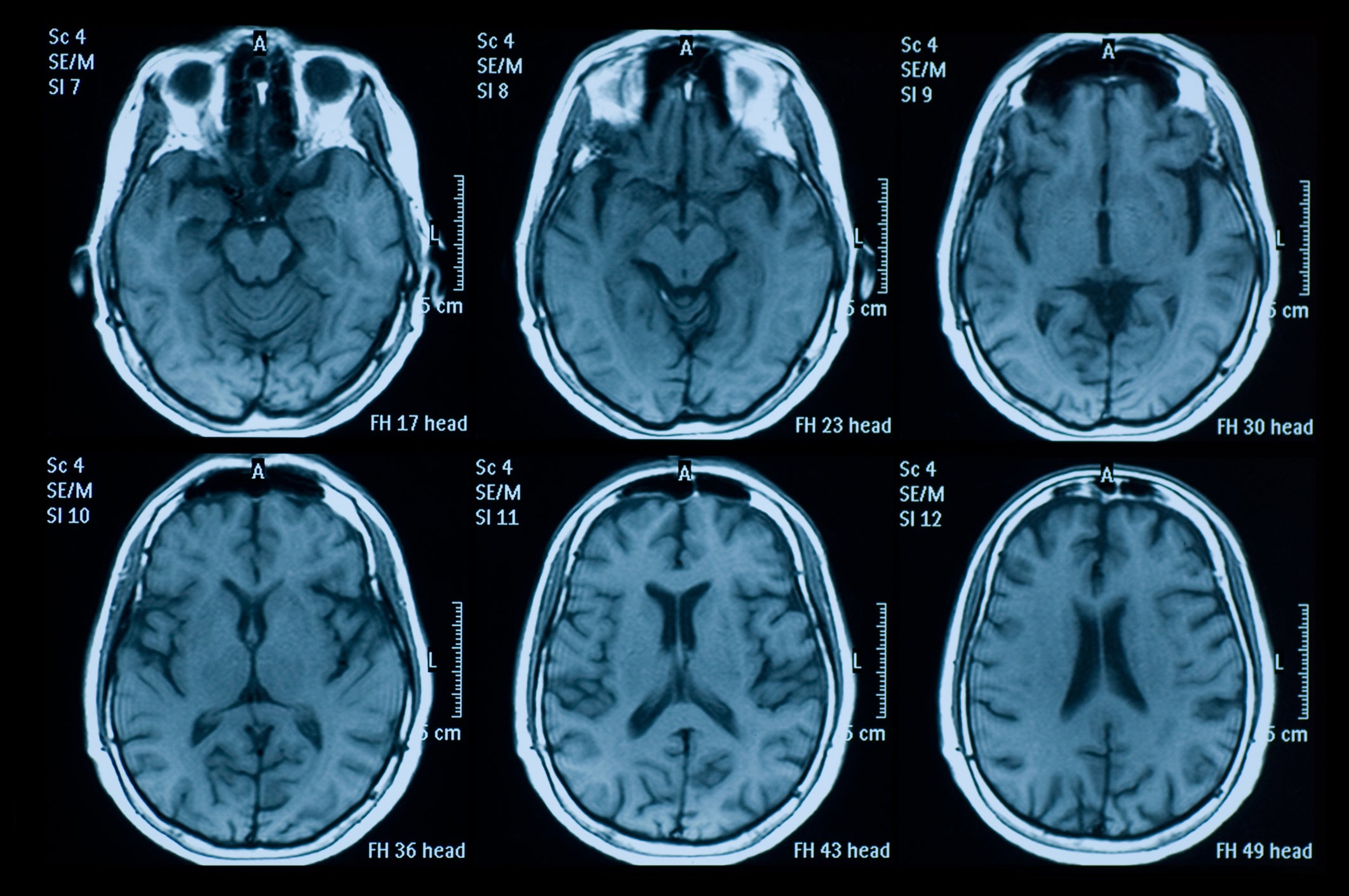 Mapped out: quantifying brain development and ageing comes with a host of technical obstacles