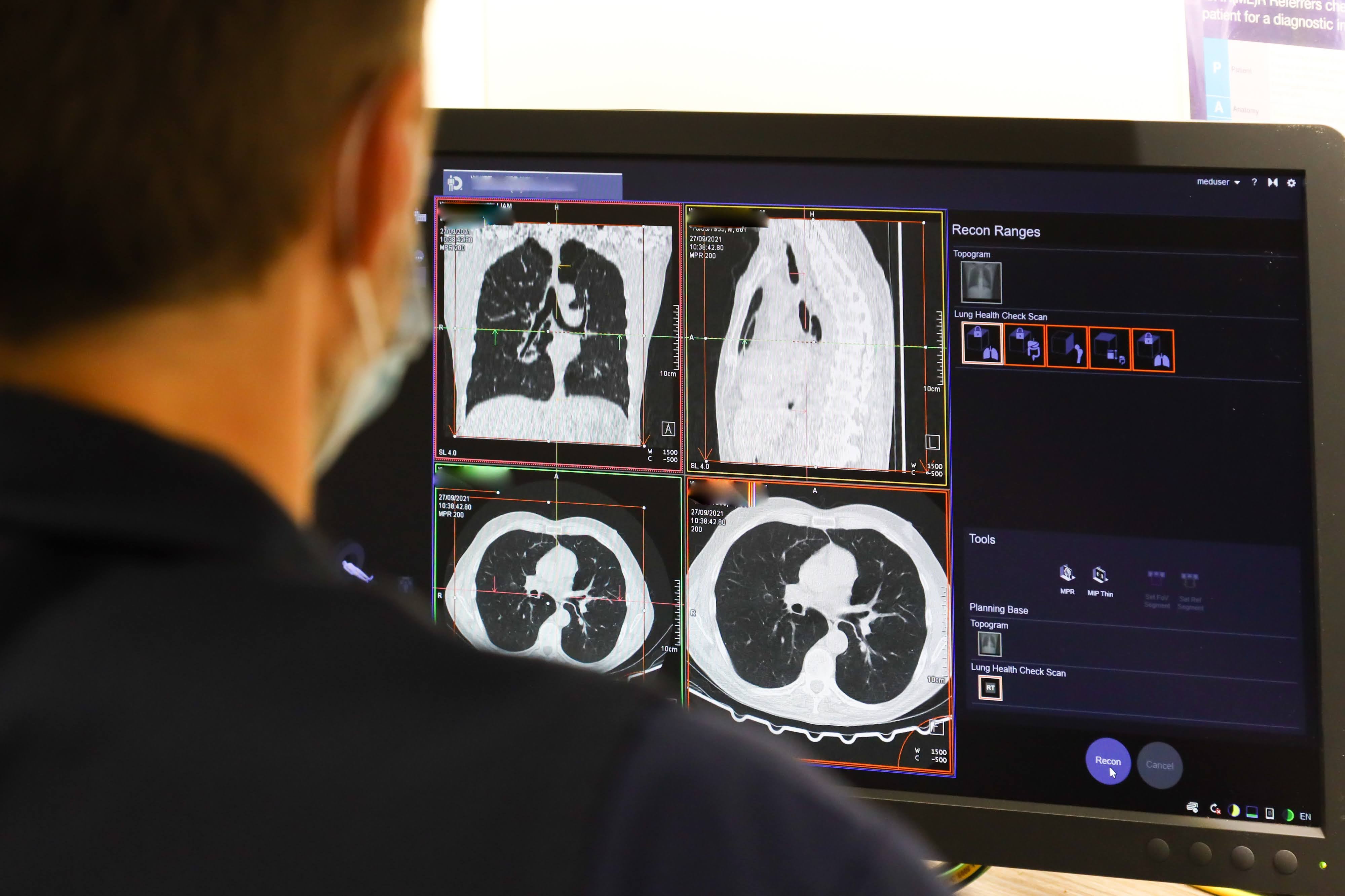 Photo issued by NHS England of a member of staff looking at the results of a lung scan