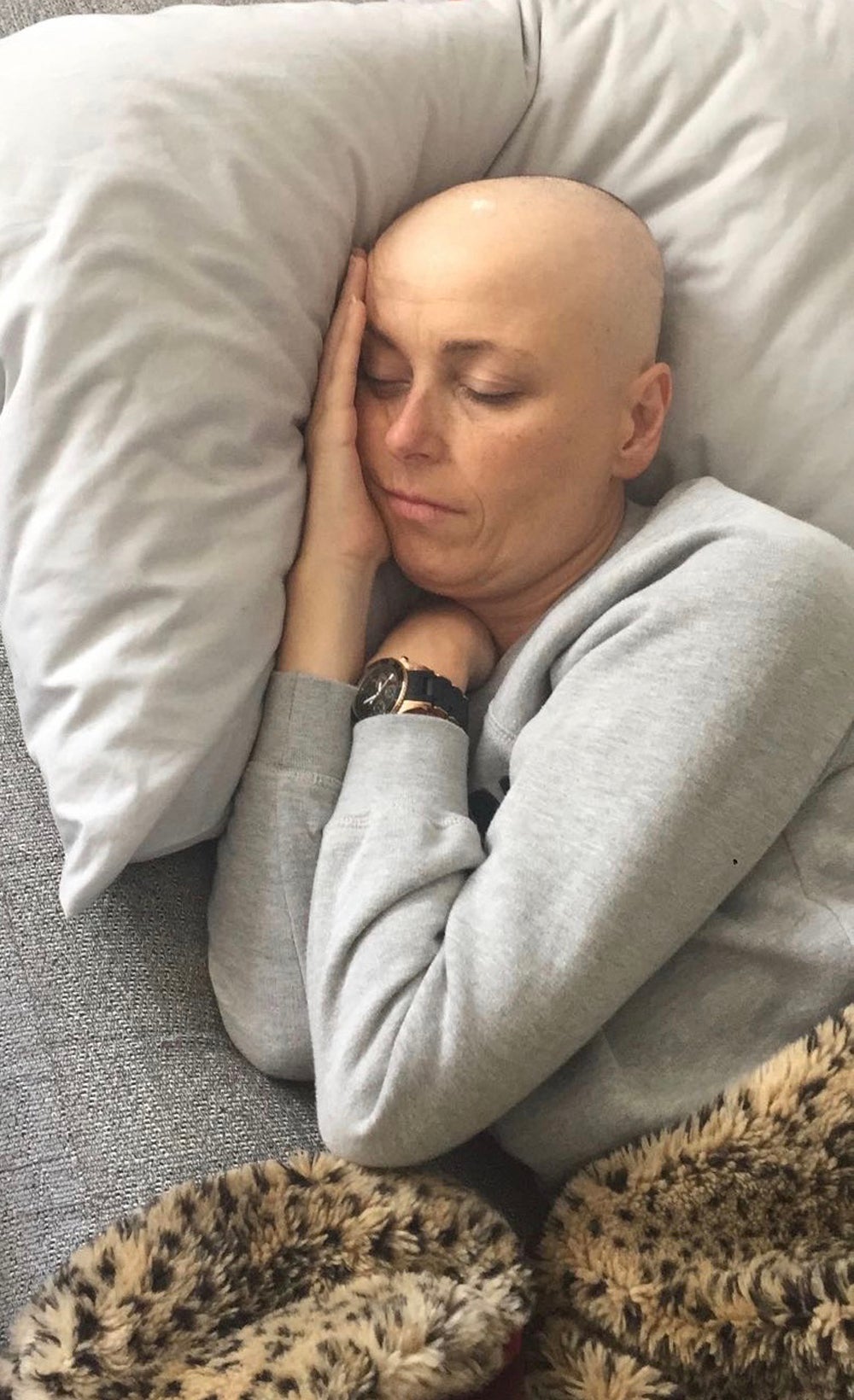Cathy sleeping after treatment in 2017 (Collect/PA Real Life)