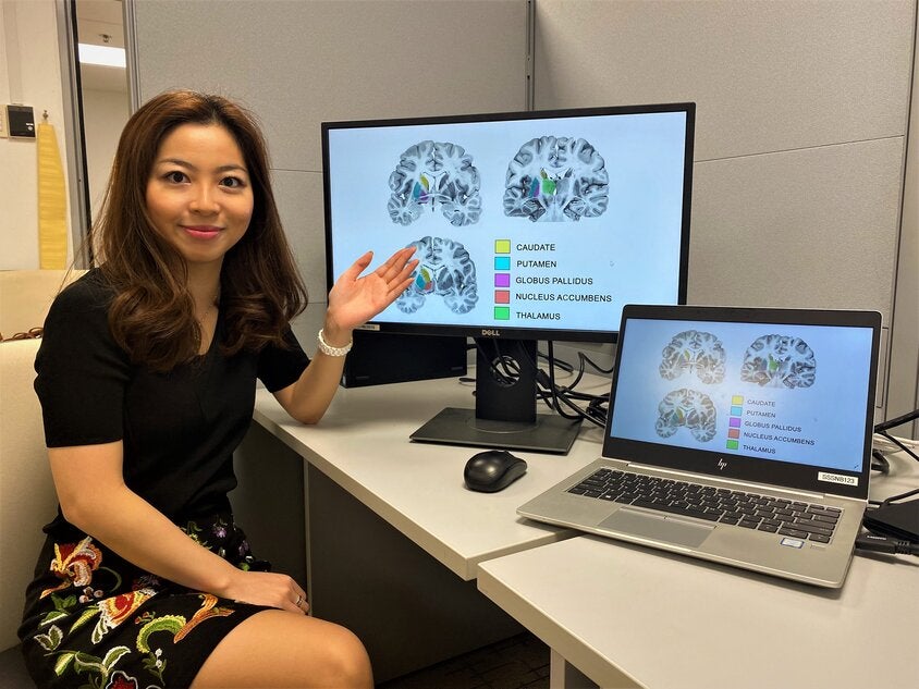 Assistant Professor Olivia Choy, a neuroscientist from NTU’s School of Social Sciences, presenting diagrams of the human striatum