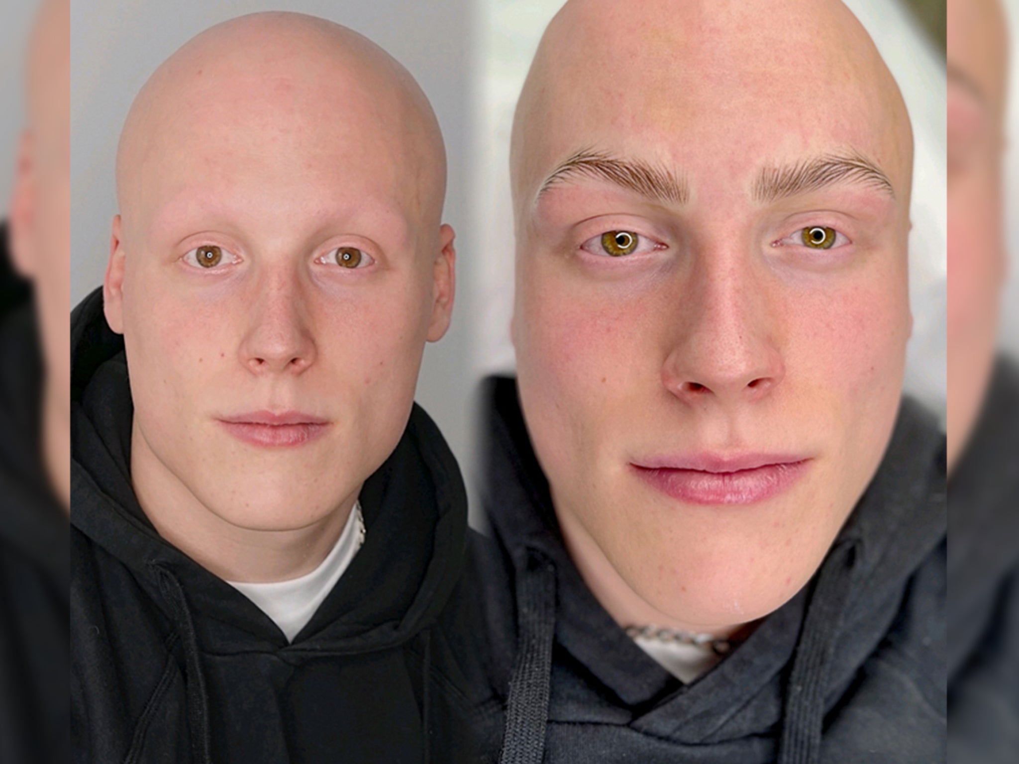 Sam before and after his eyebrow treatment