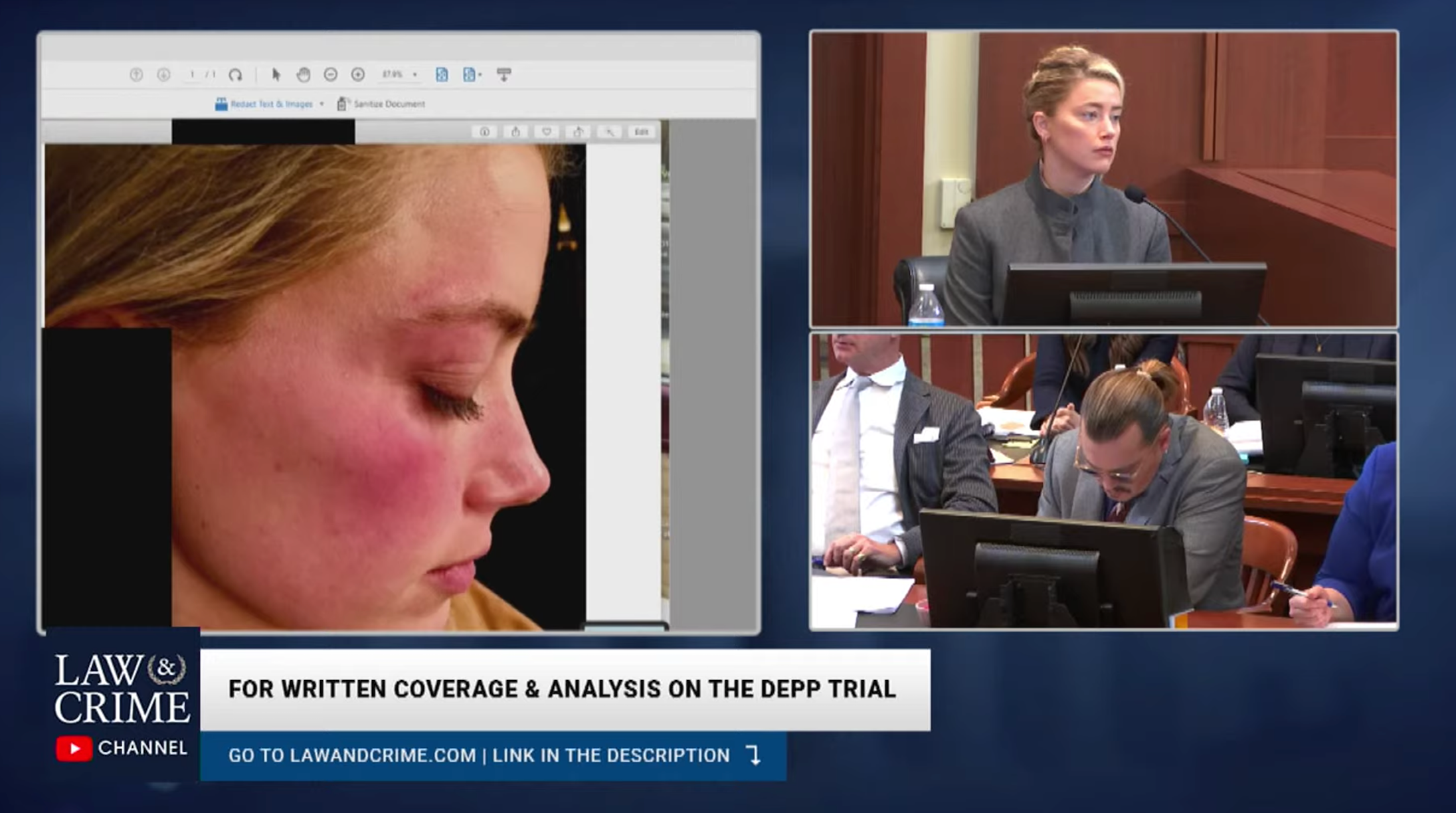 The jury was shown photos of Amber Heard’s face as evidence