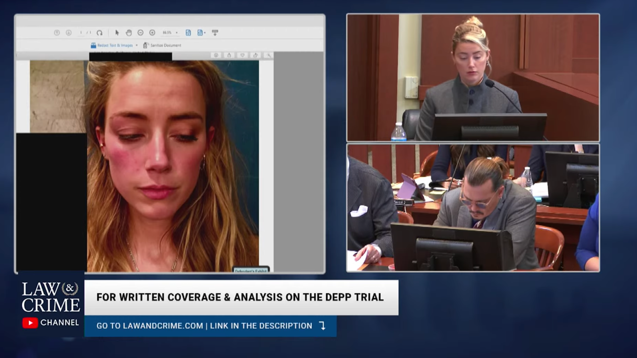 The jury was shown photos of Amber Heard’s face as evidence