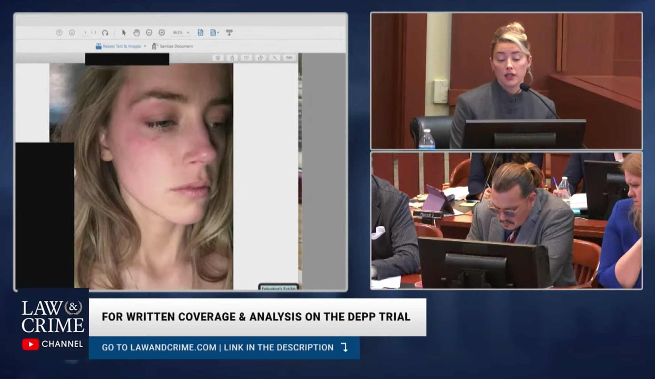 The jury was shown photos of Amber Heard’s face as evidence