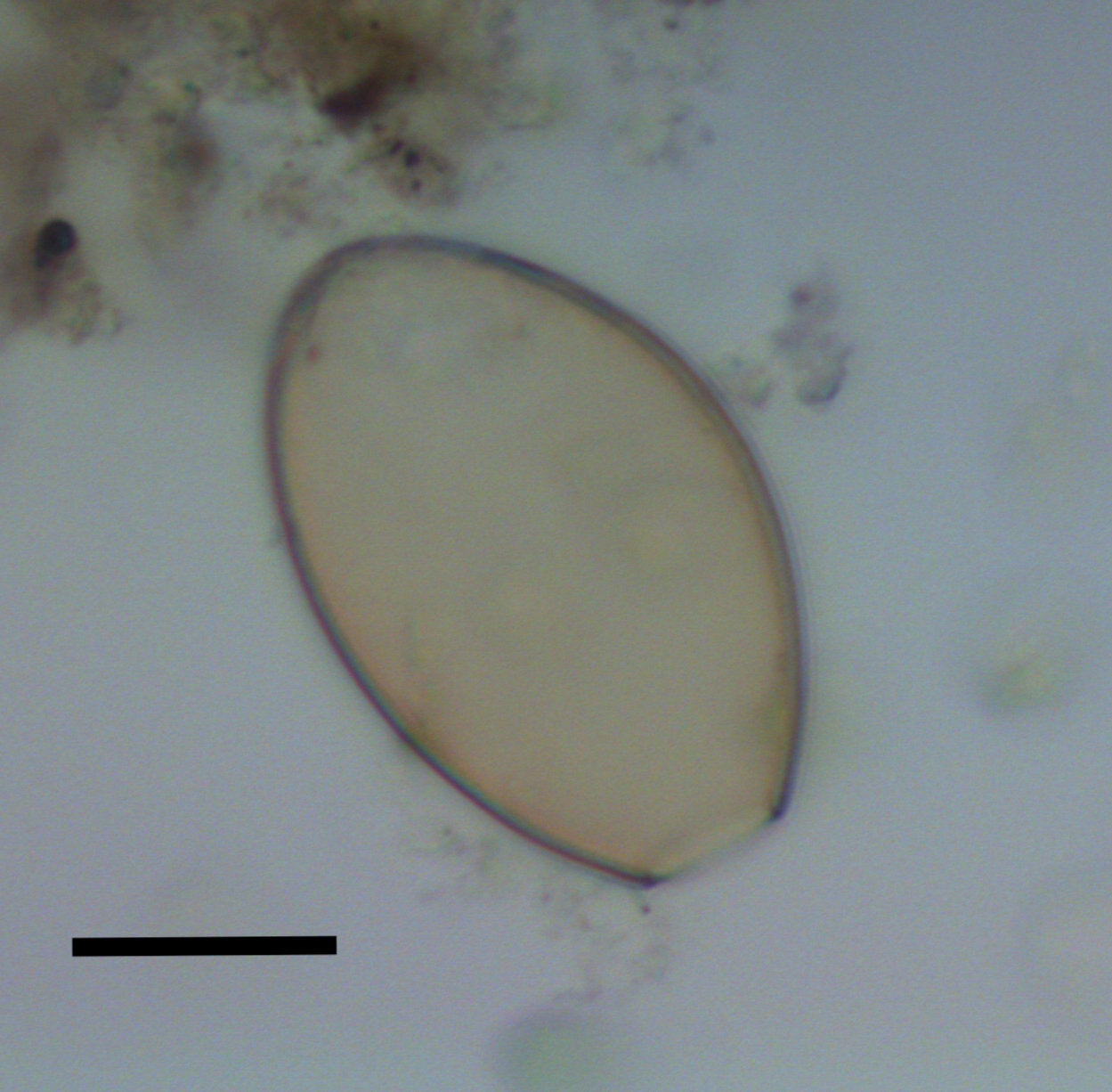 Microscopic egg of fish tapeworm found in dog coprolite Black scale bar represents 20 micrometres