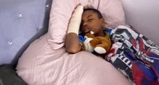 Black boy, 11, loses finger while fleeing ‘school bullies’