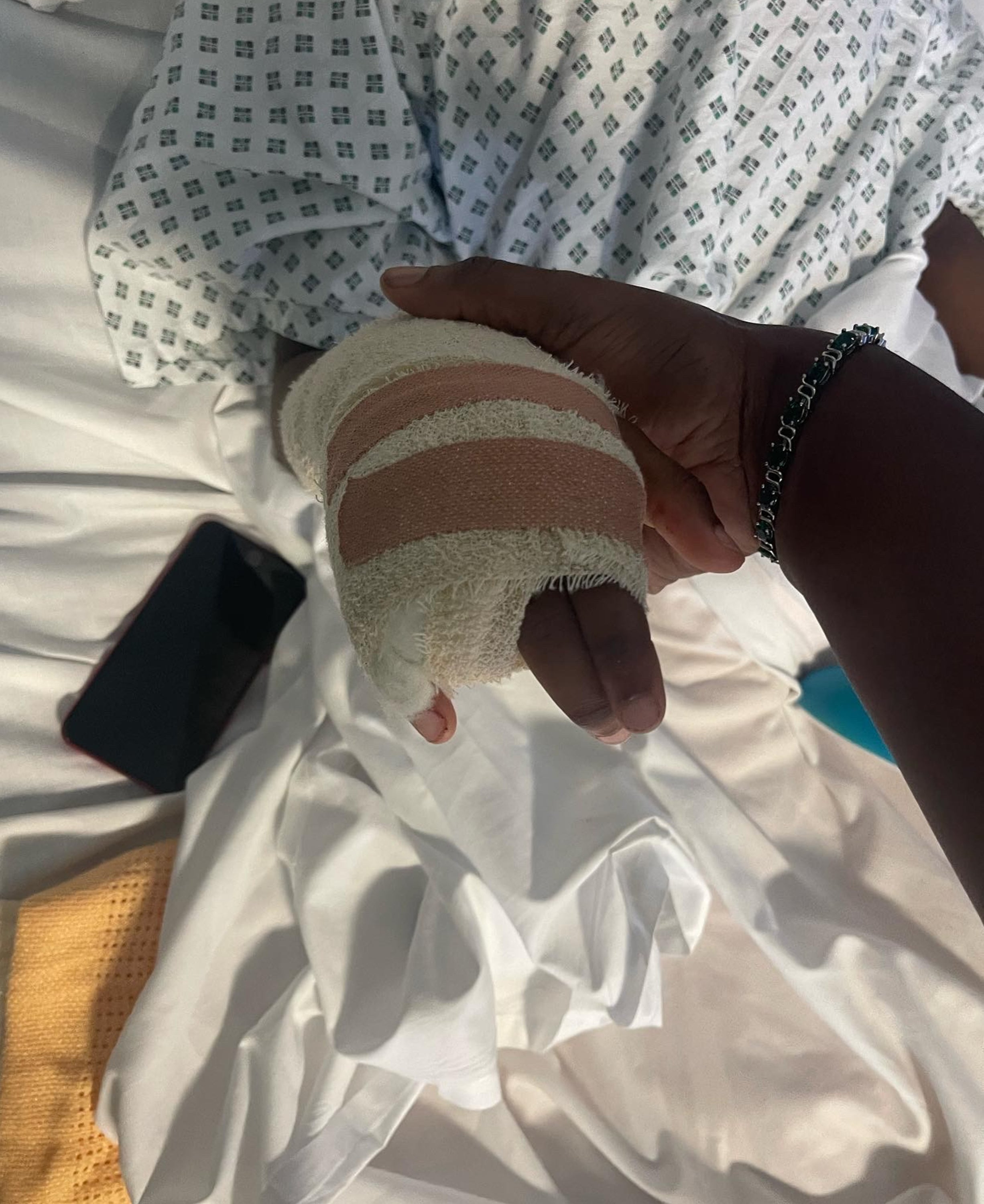 Raheem Bailey had his finger amputated