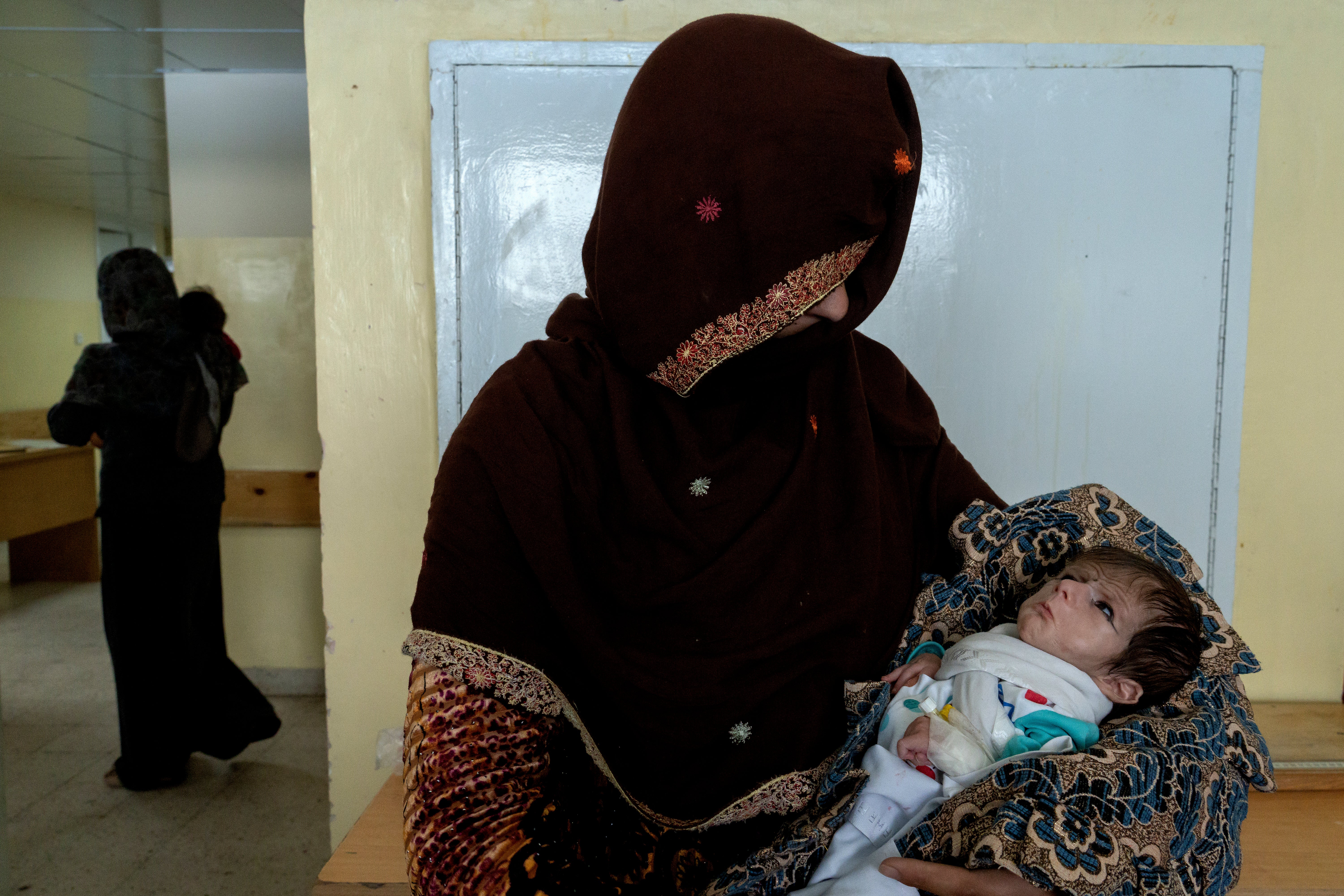 A mother holds her malnourished baby at the malnutrition ward of the Indira Gandhi hospital in Kabul, Afghanistan