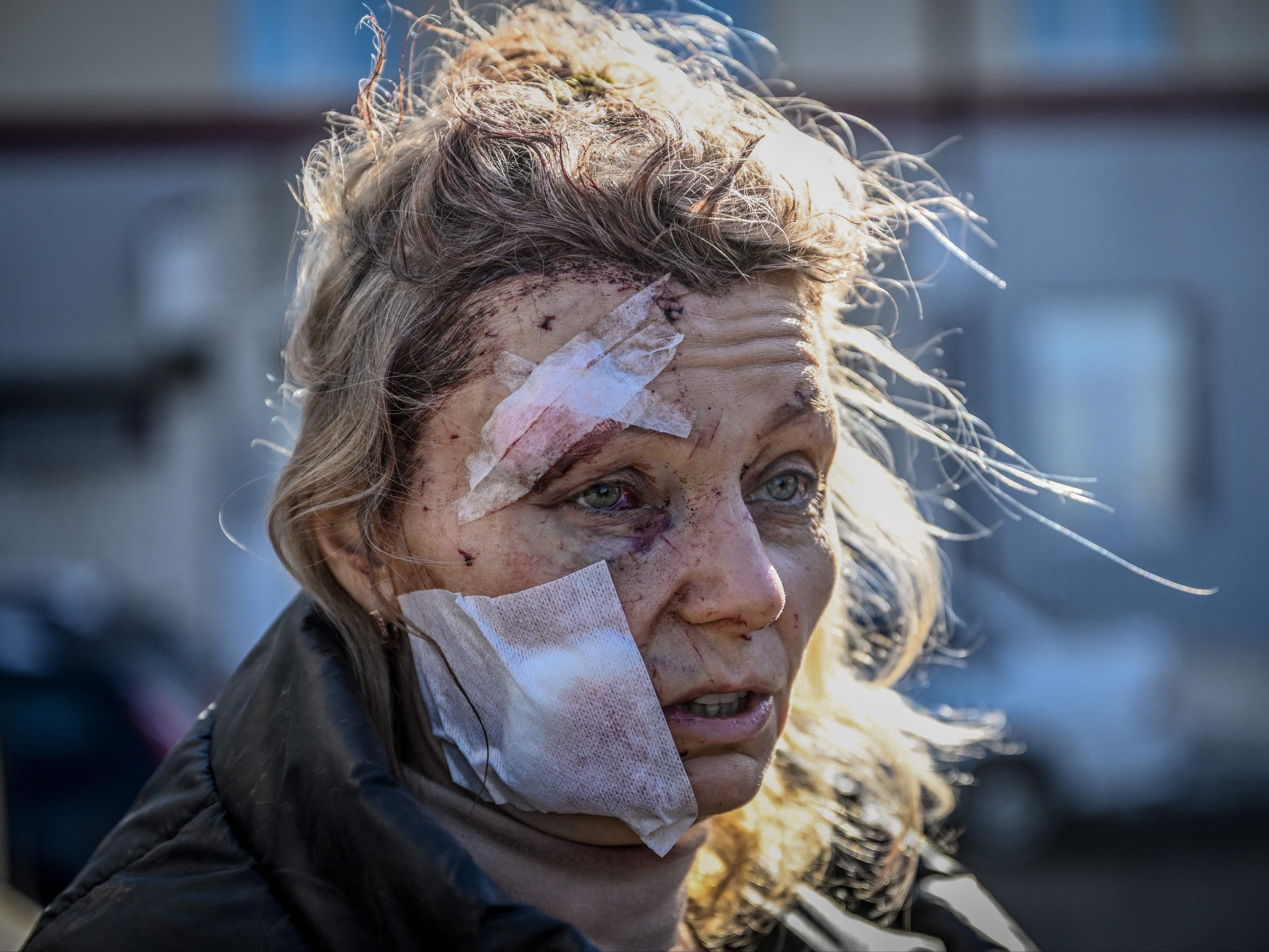 Helena, a 53-year-old teacher, stands outside a hospital after the bombing of the eastern Ukraine town of Chuguiv on 24 February