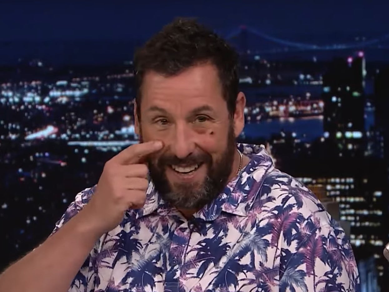 Adam Sandler on ‘The Tonight Show’, sporting a black eye