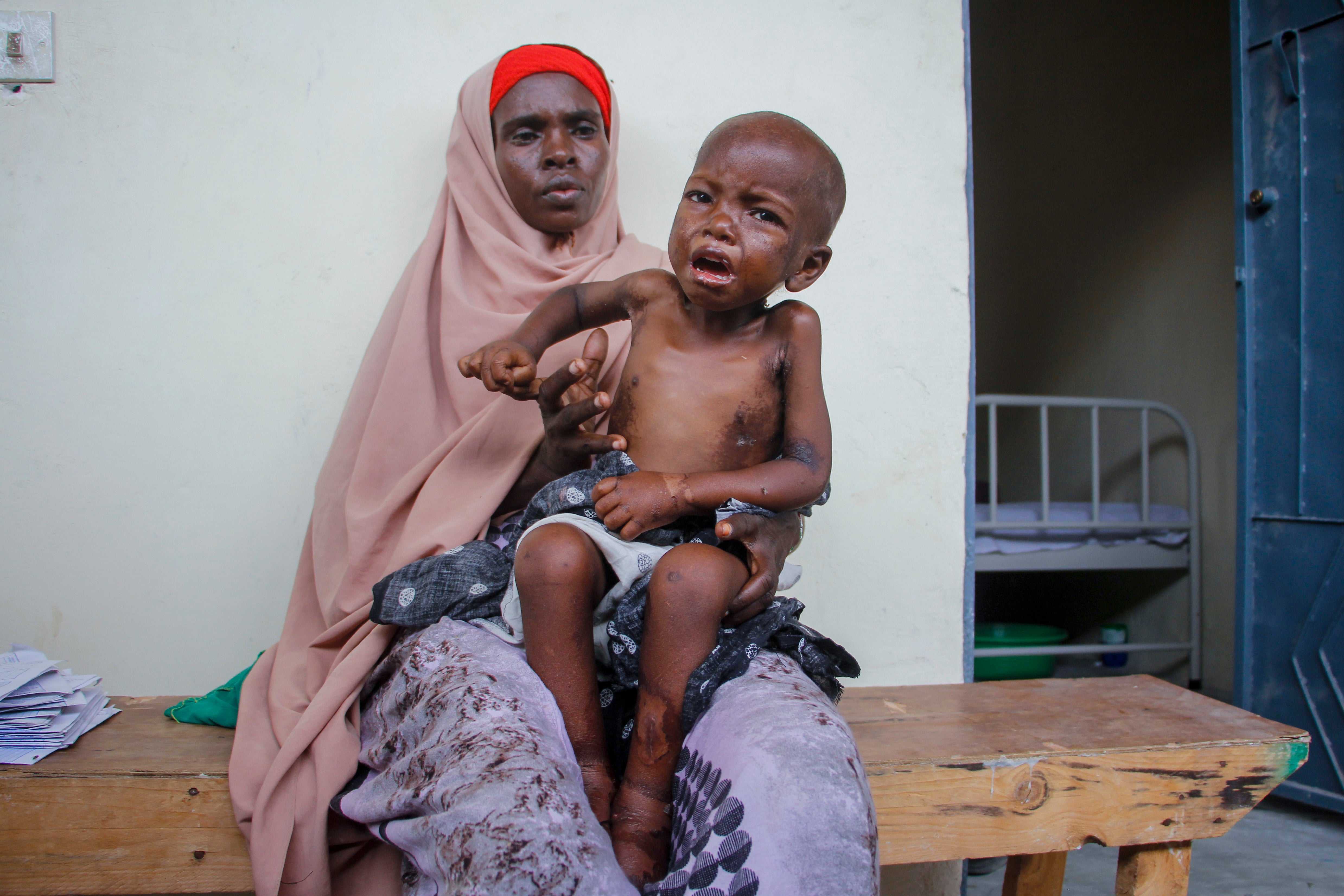 Somalia Dying in Drought