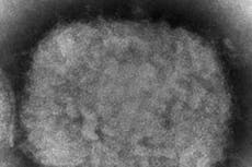 US buys more monkeypox vaccine as global case count grows