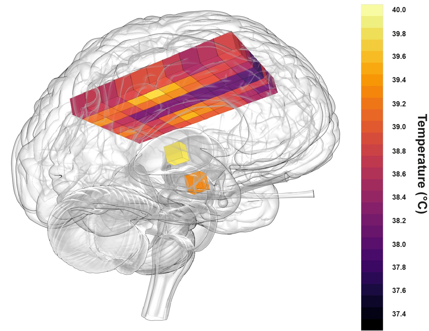 Healthy human brains are hotter than previously thought, exceeding 40C – study (N Rzechorzek/MRC LMB/Brain)