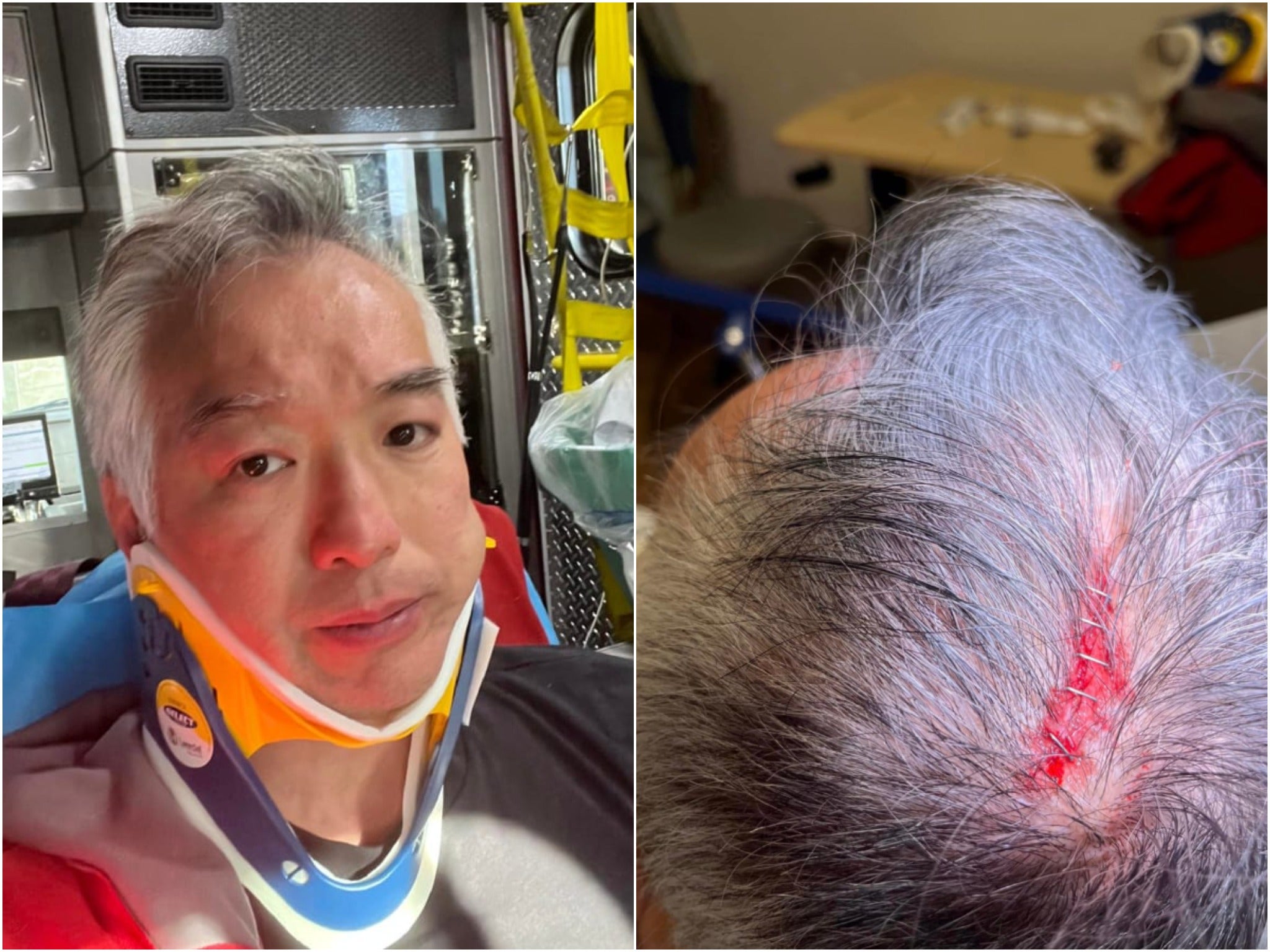 A cement block was dropped on the head of a San Francisco councilman in an apparent hate crime