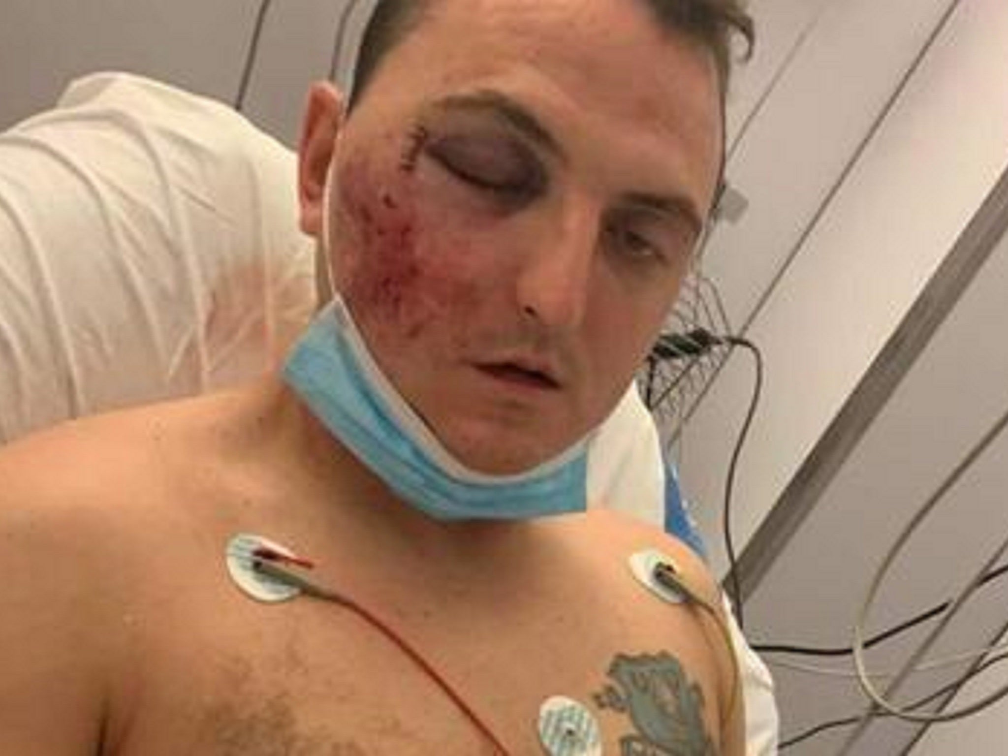 British tourist Steen Nodwell, 29, has been left with a fractured skull and broken arms after allegedly being pushed off a cliff in Spain