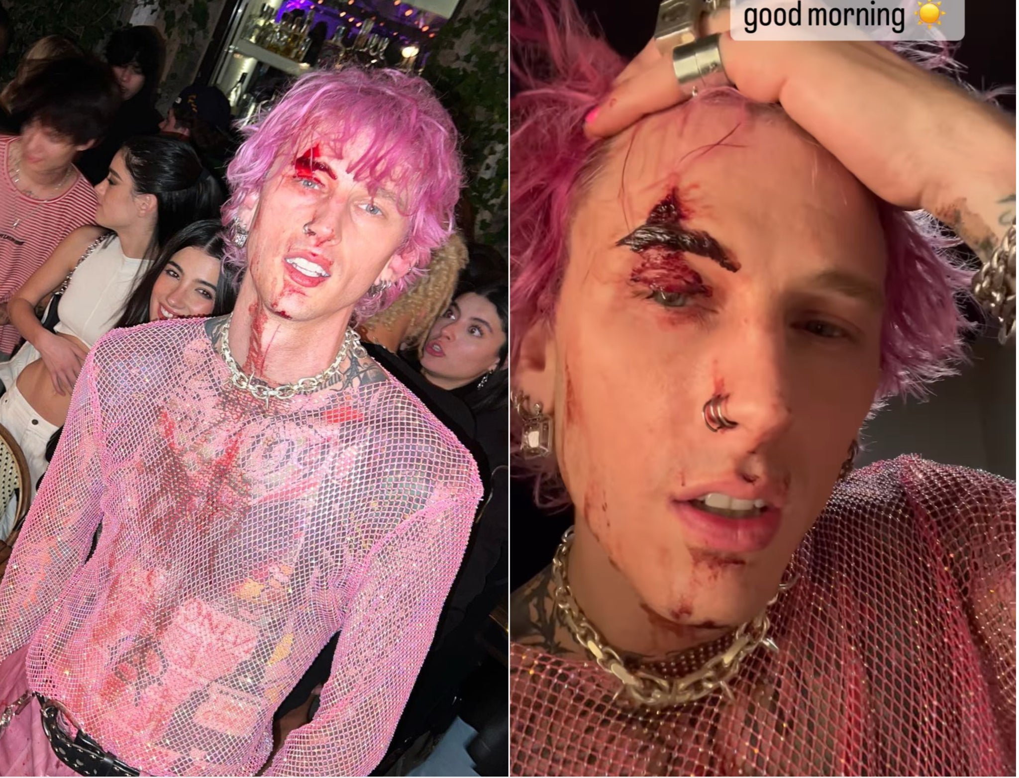 Machine Gun Kelly shares photos of gash on face after smashing glass on himself during performance