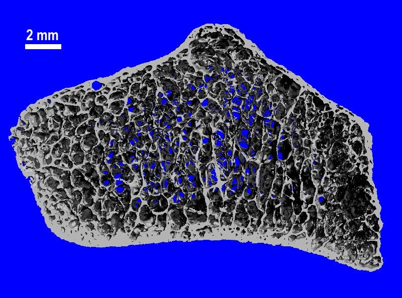 A high resolution image of an astronaut’s wrist bone