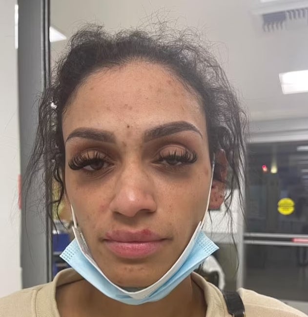 Mychelle Johnson posted images of her injuries on social media