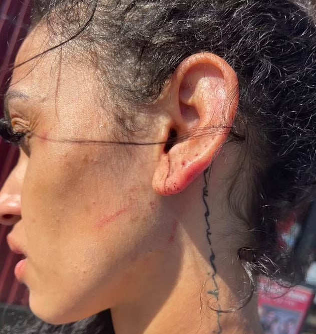 Mychelle Johnson posted images of her injuries on social media